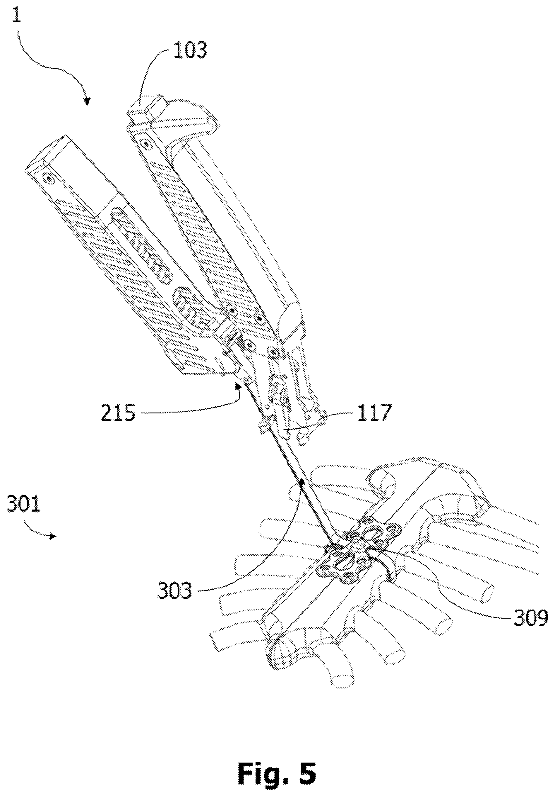 Patent US12564432 Figure 5 – Surgical tensioning instrument