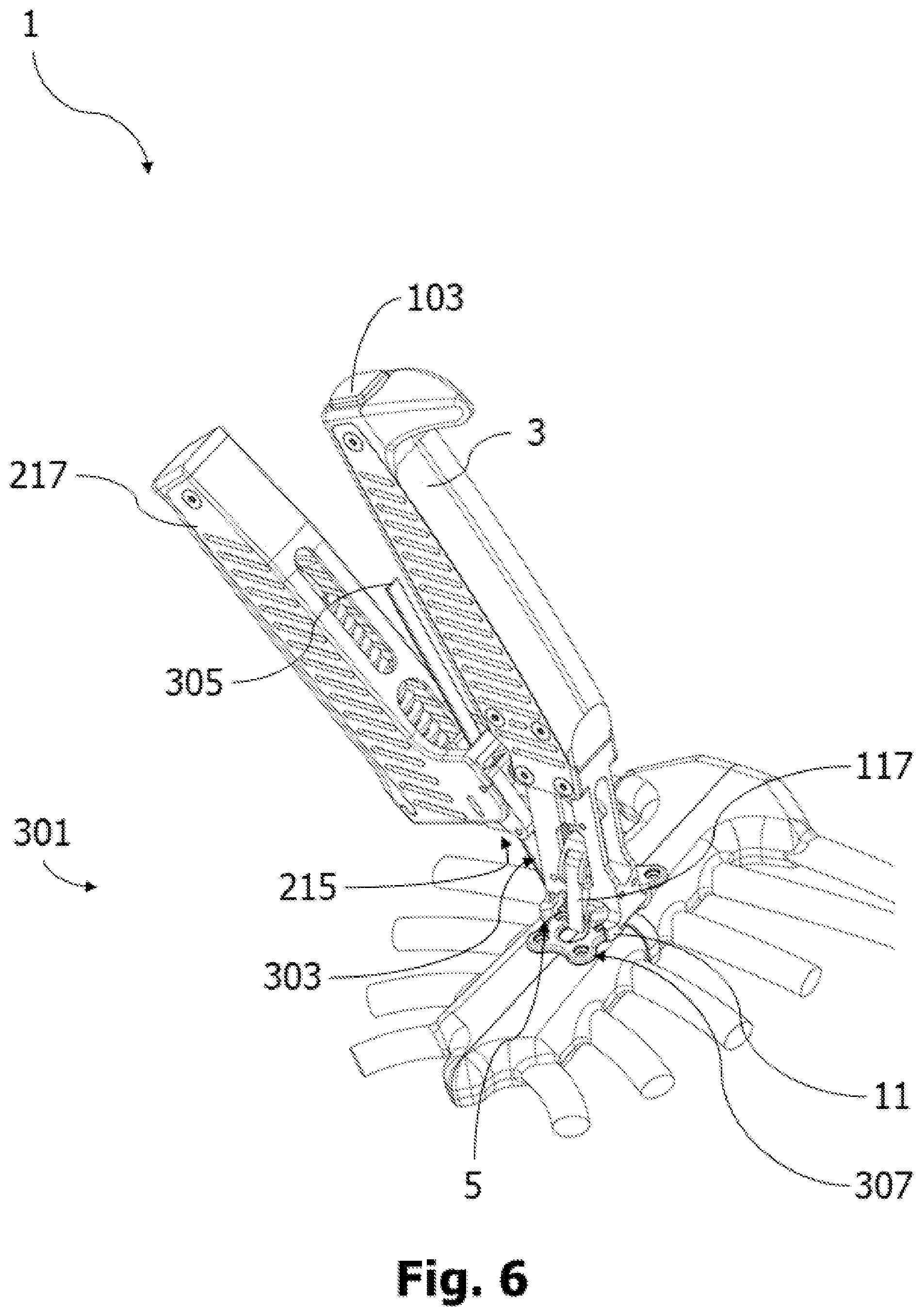 Patent US12564432 Figure 6 – Surgical tensioning instrument
