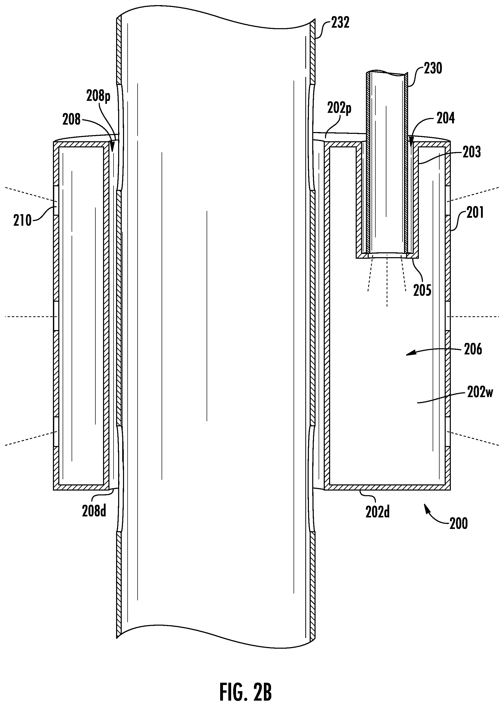 Patent US12564434 Figure 3 – Devices and methods for fluid distribution from a catheter
