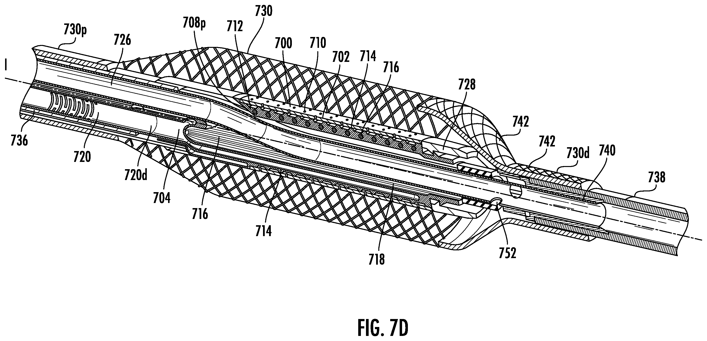 Patent US12564434 Figure 12 – Devices and methods for fluid distribution from a catheter