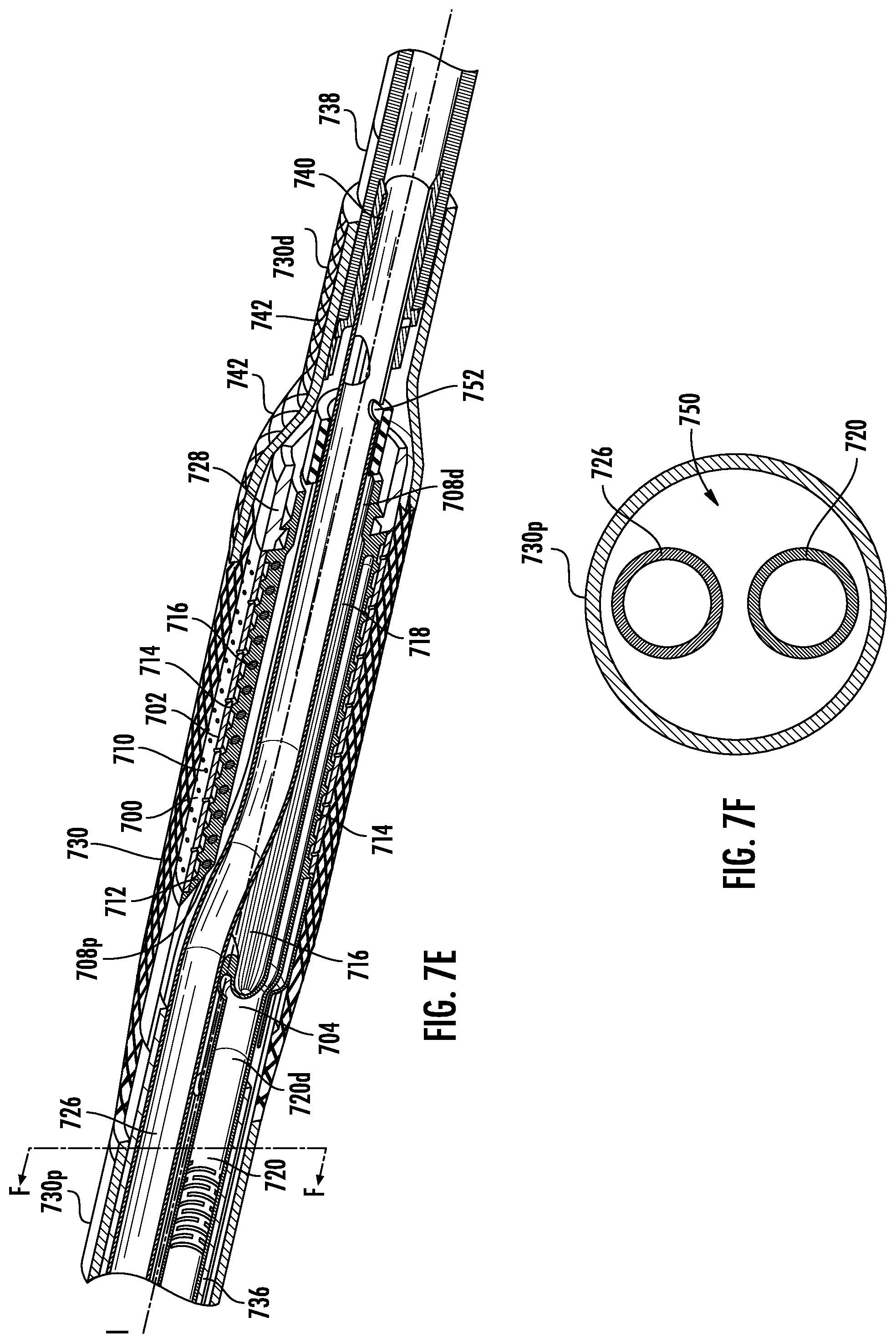 Patent US12564434 Figure 13 – Devices and methods for fluid distribution from a catheter