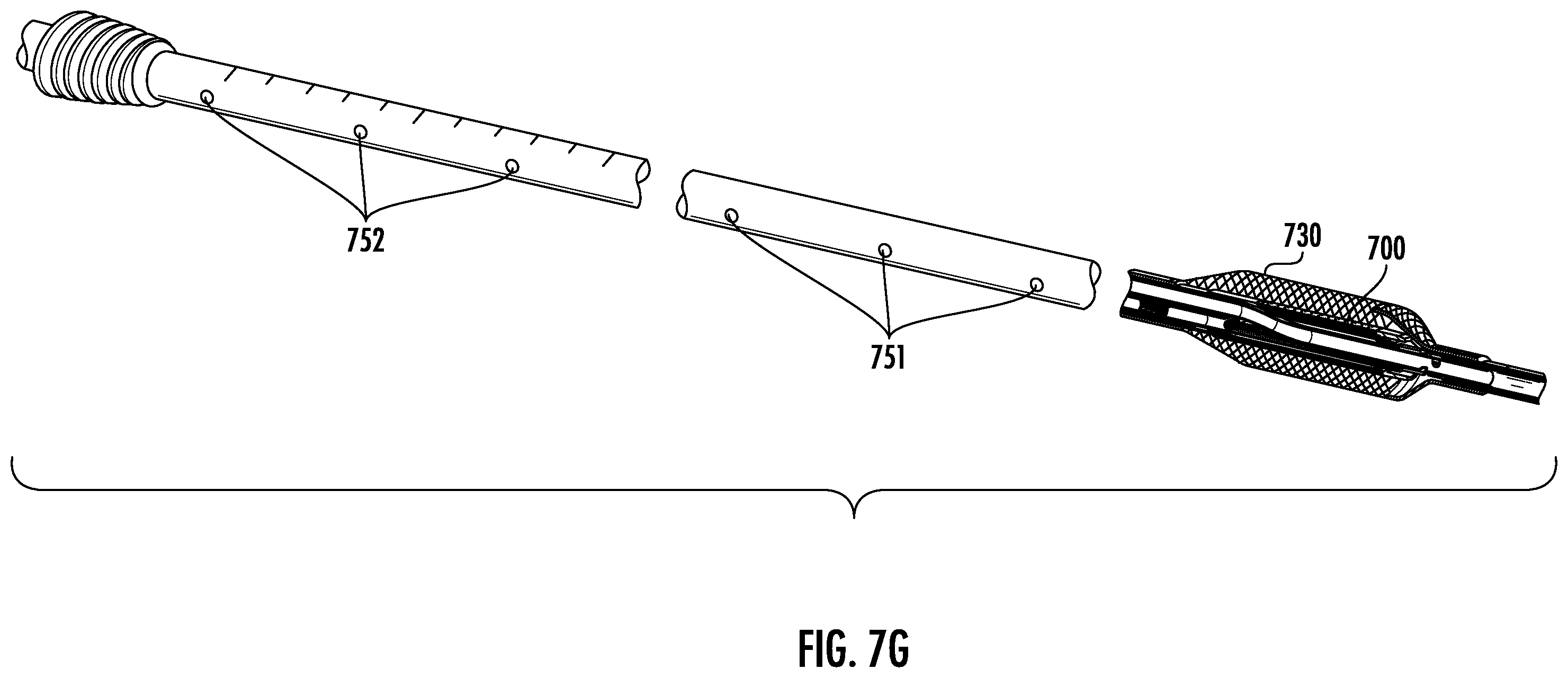 Patent US12564434 Figure 14 – Devices and methods for fluid distribution from a catheter