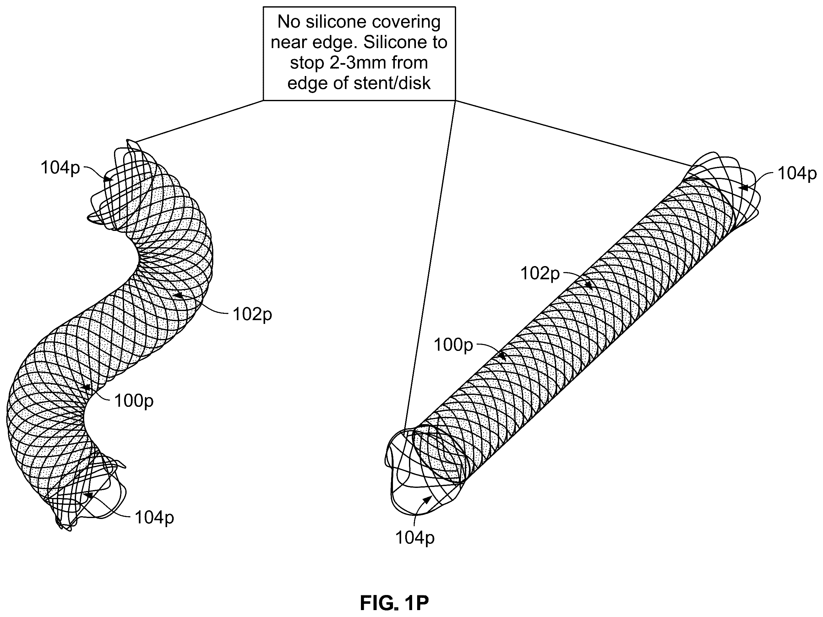 Patent US12564435 Figure 16 – Multi-dose duodenal ablation through an endoscope