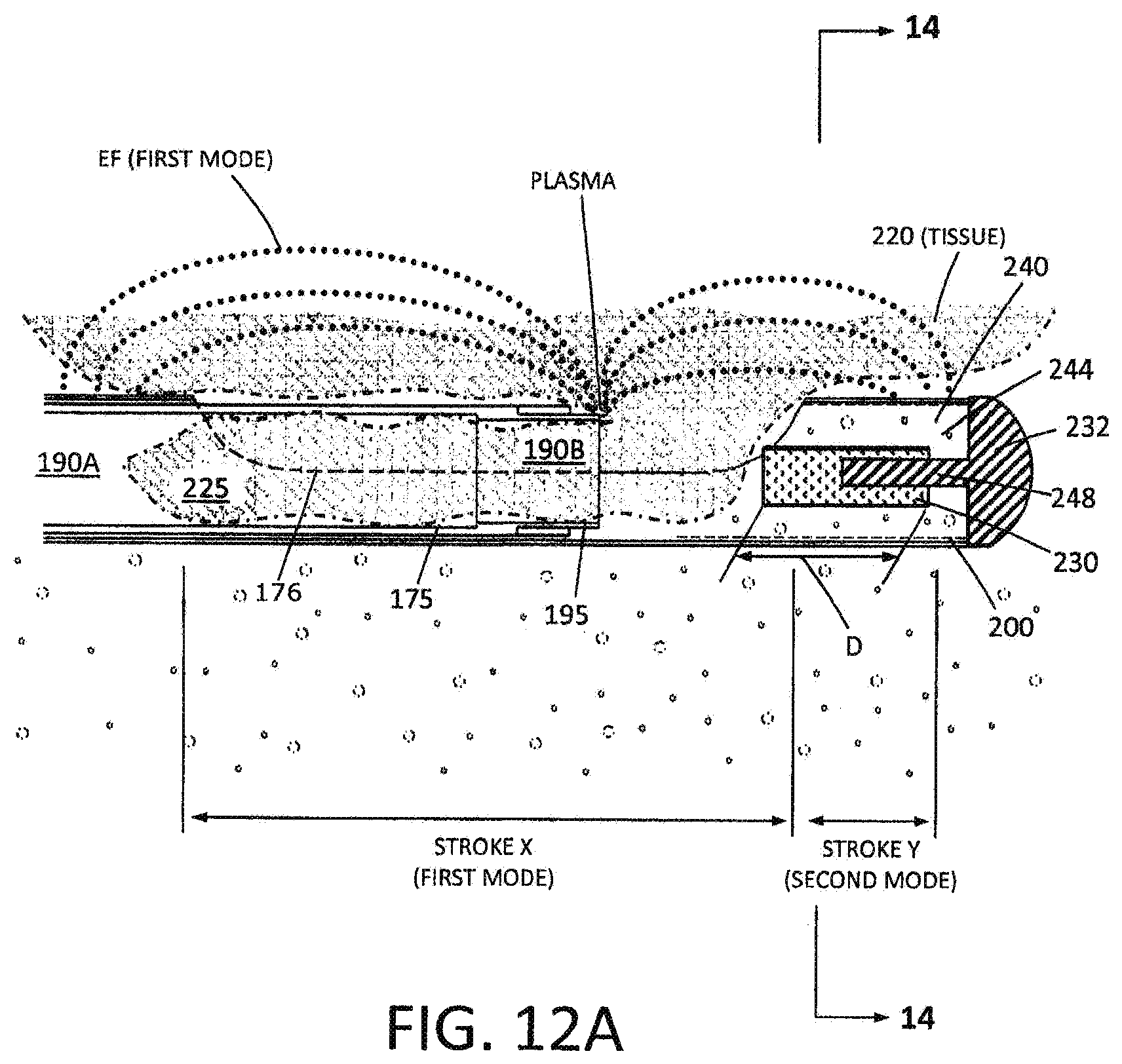 Patent US12564437 Figure 11 – Medical device and methods