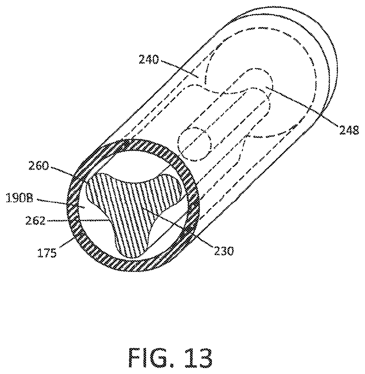 Patent US12564437 Figure 14 – Medical device and methods