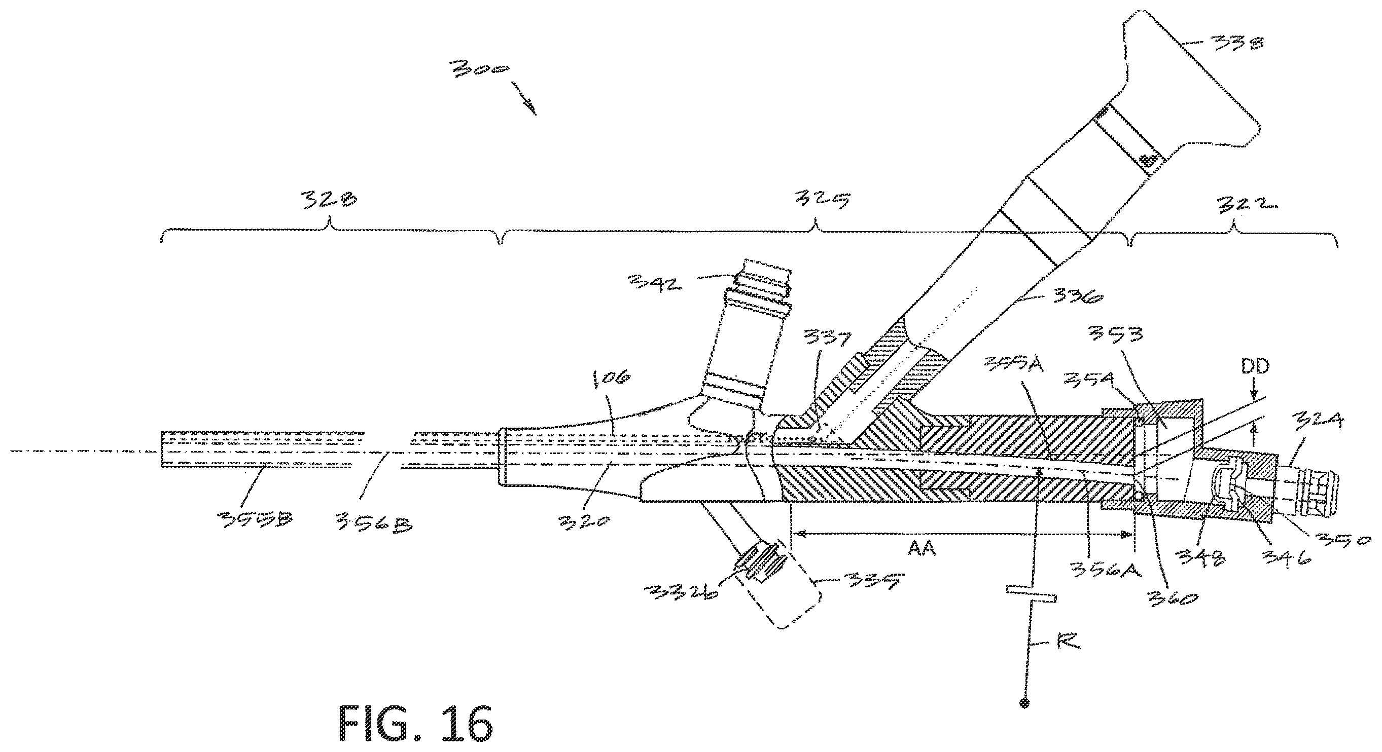Patent US12564437 Figure 17 – Medical device and methods