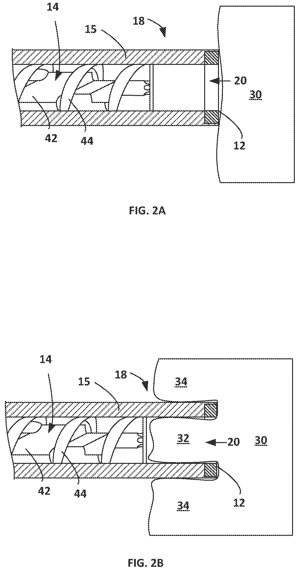 Patent US12564438 Figure 2 – Energized corers with powered conveying