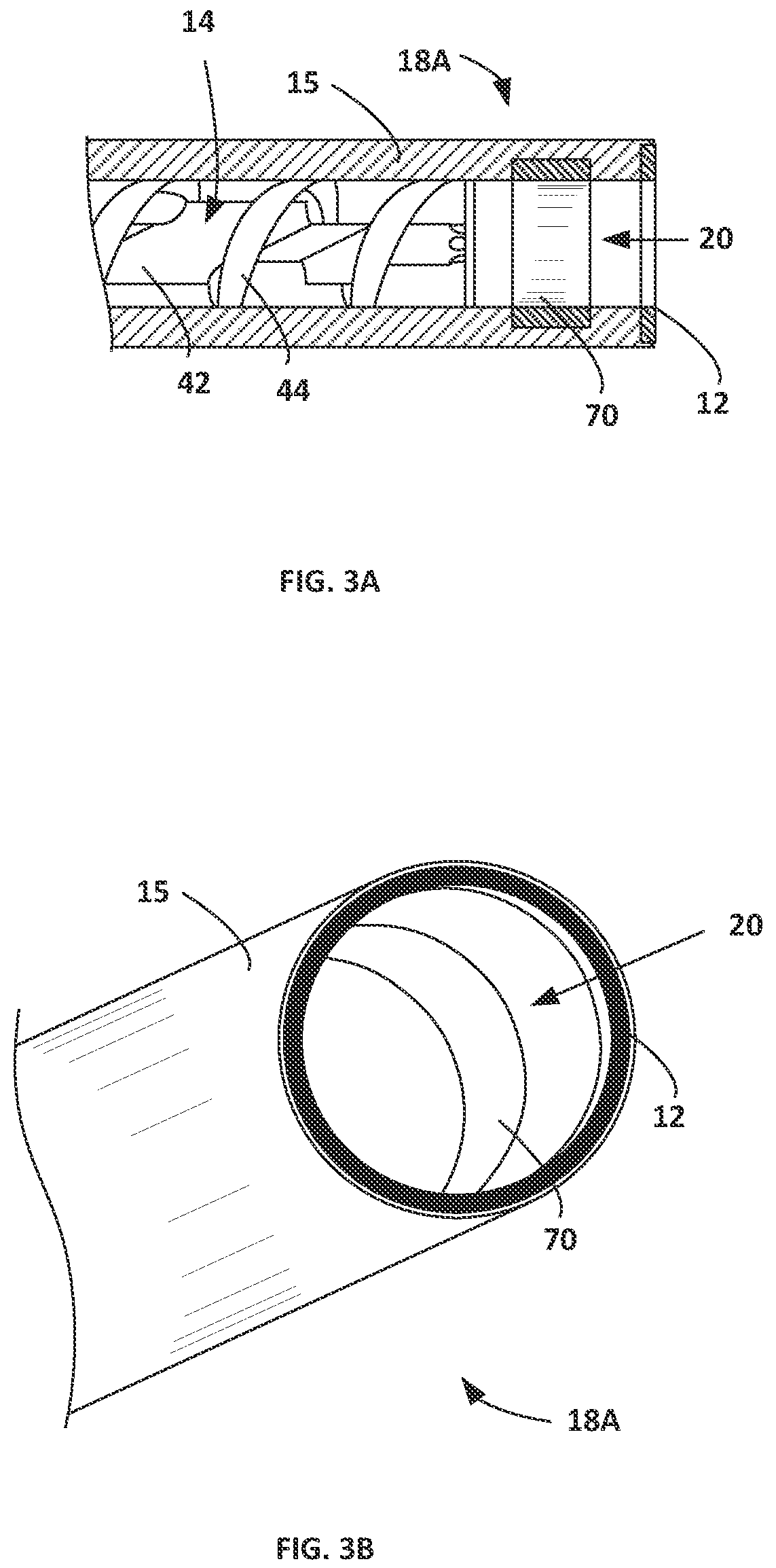 Patent US12564438 Figure 4 – Energized corers with powered conveying