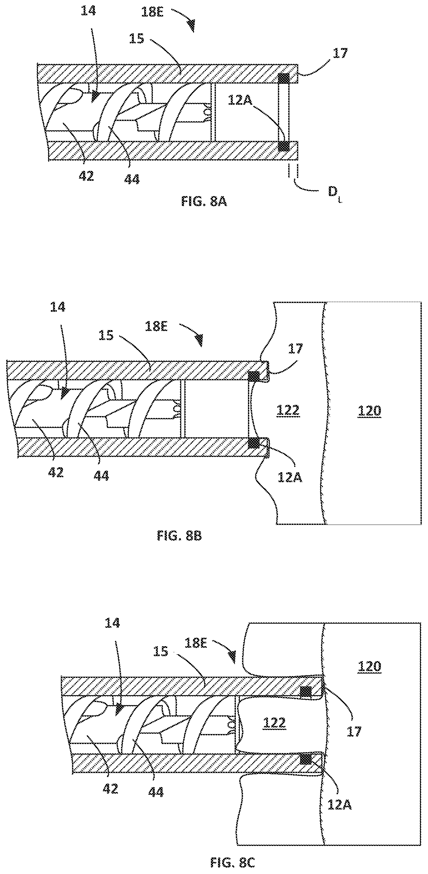 Patent US12564438 Figure 9 – Energized corers with powered conveying