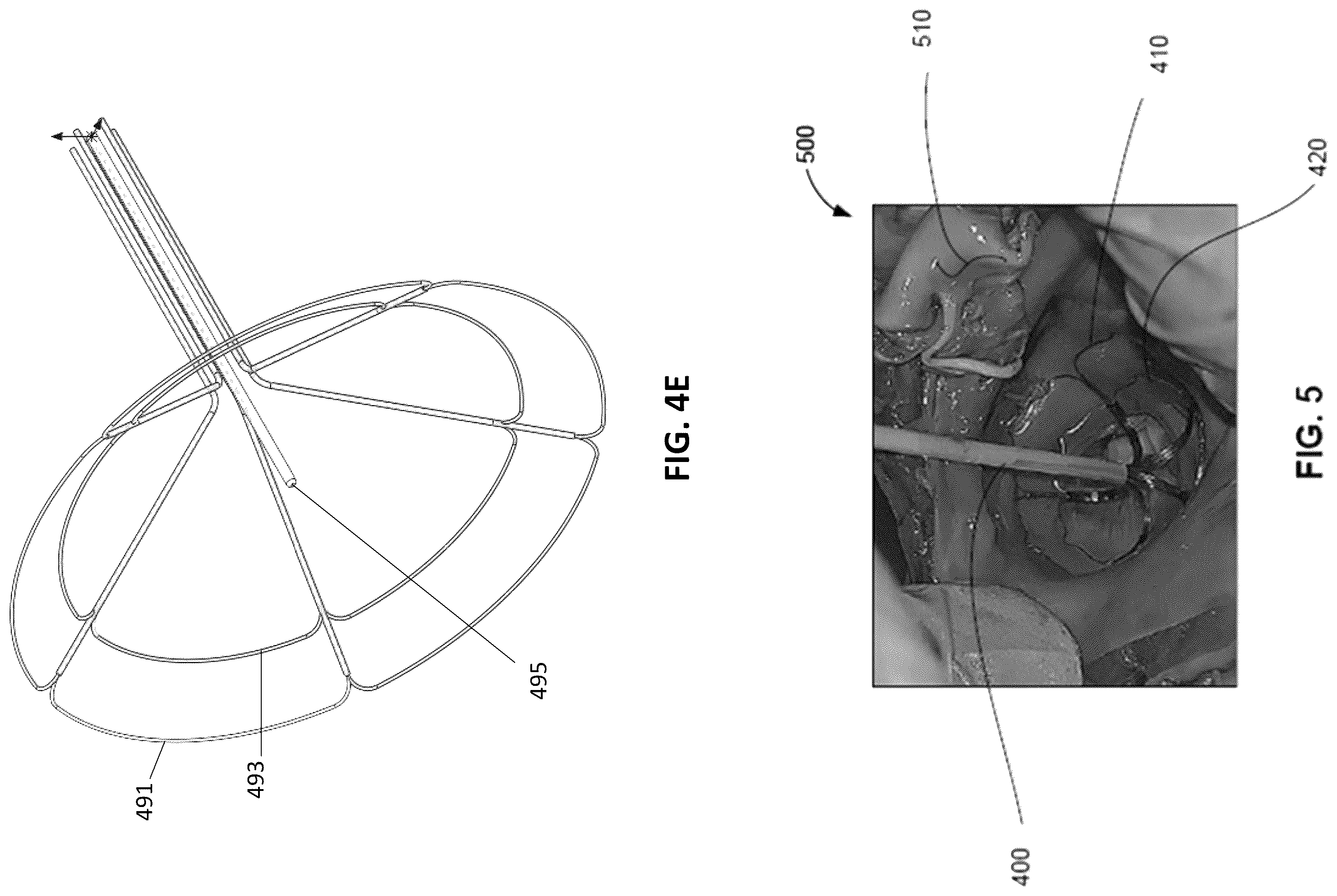Patent US12564440 Figure 5 – Multi-strut ablation and sensing catheter devices and methods