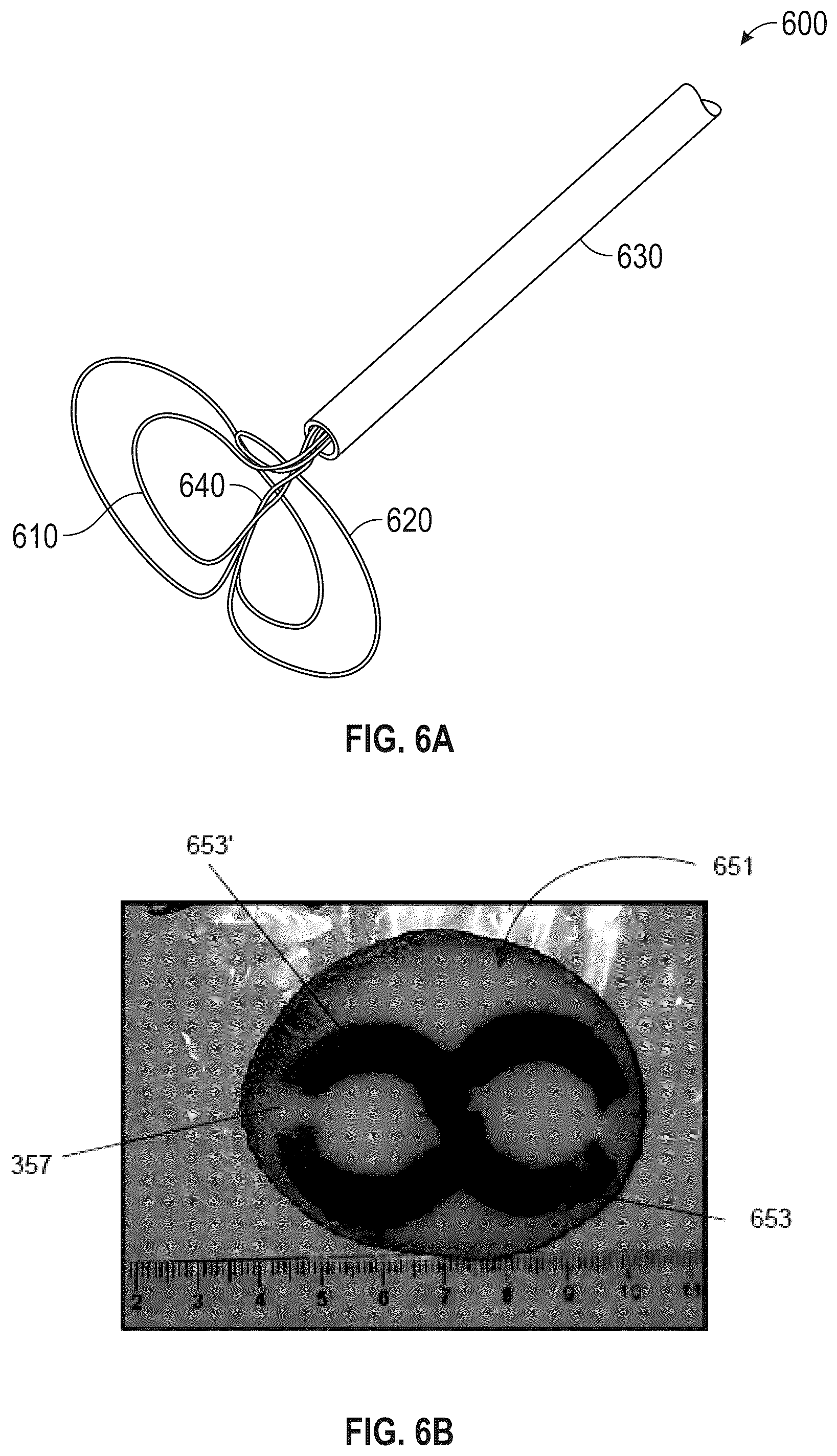 Patent US12564440 Figure 6 – Multi-strut ablation and sensing catheter devices and methods