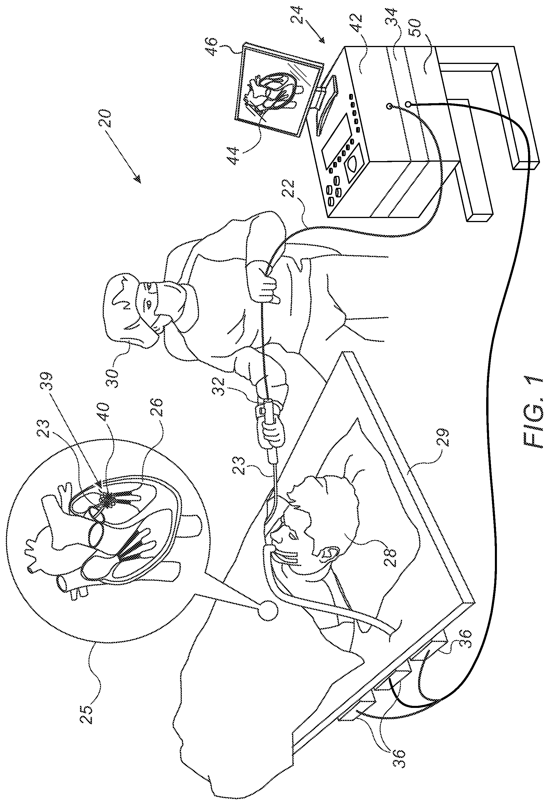 Patent US12564441 Figure 1 – Basket catheter having insulated ablation electrodes and diagnostic electrodes