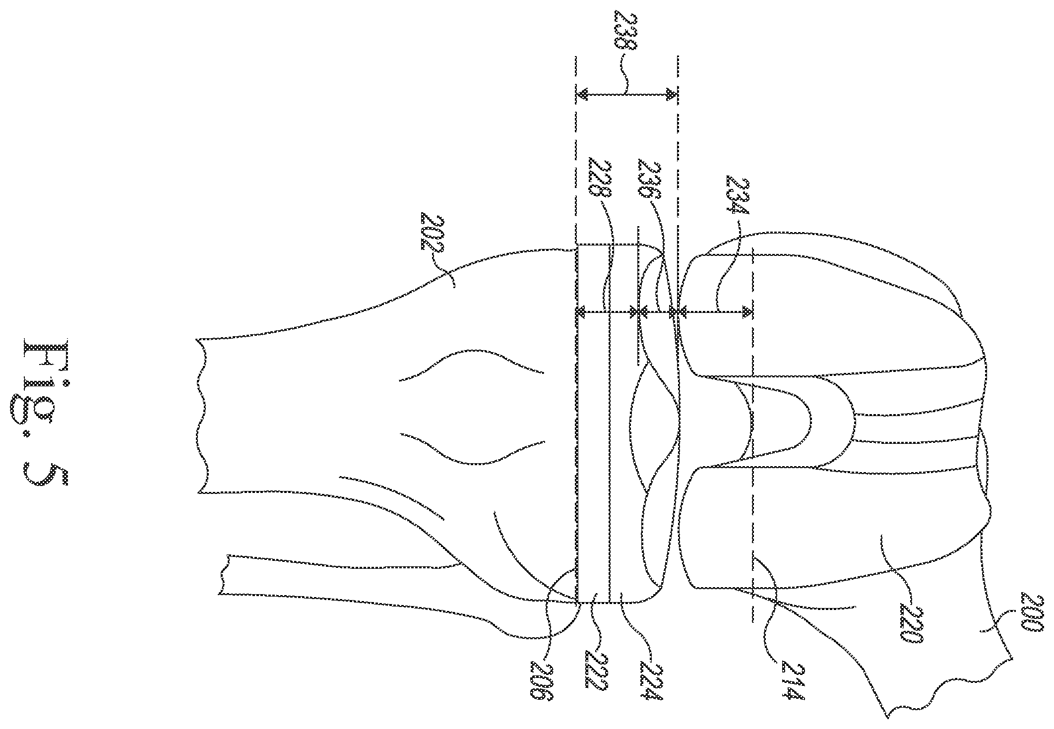 Patent US12564446 Figure 5 – Systems and methods for planning and assisting orthopaedic surgical procedures