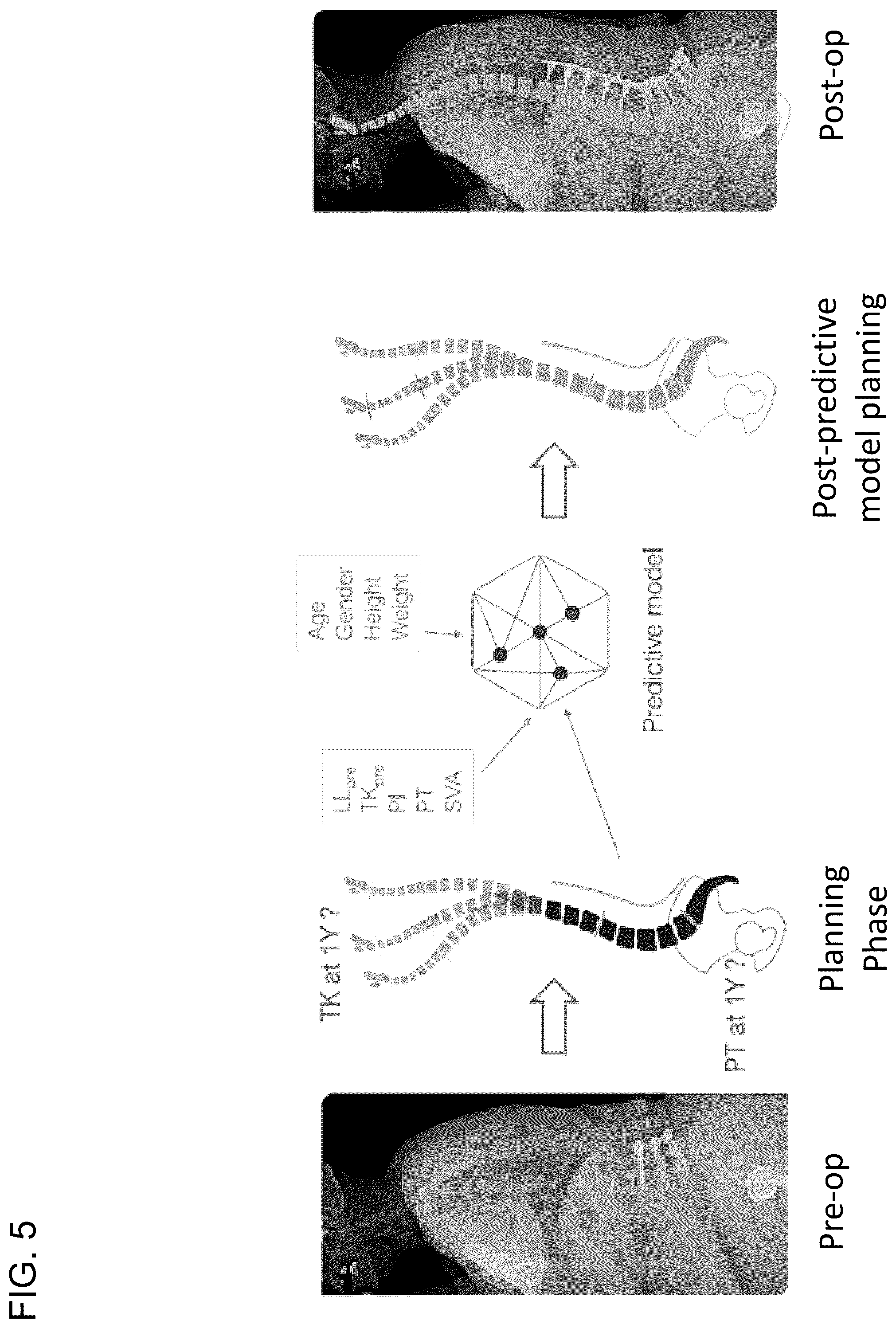 Patent US12564447 Figure 5 – Systems, methods, and devices for developing patient-specific spinal implants, treatments, operations, and/or procedures