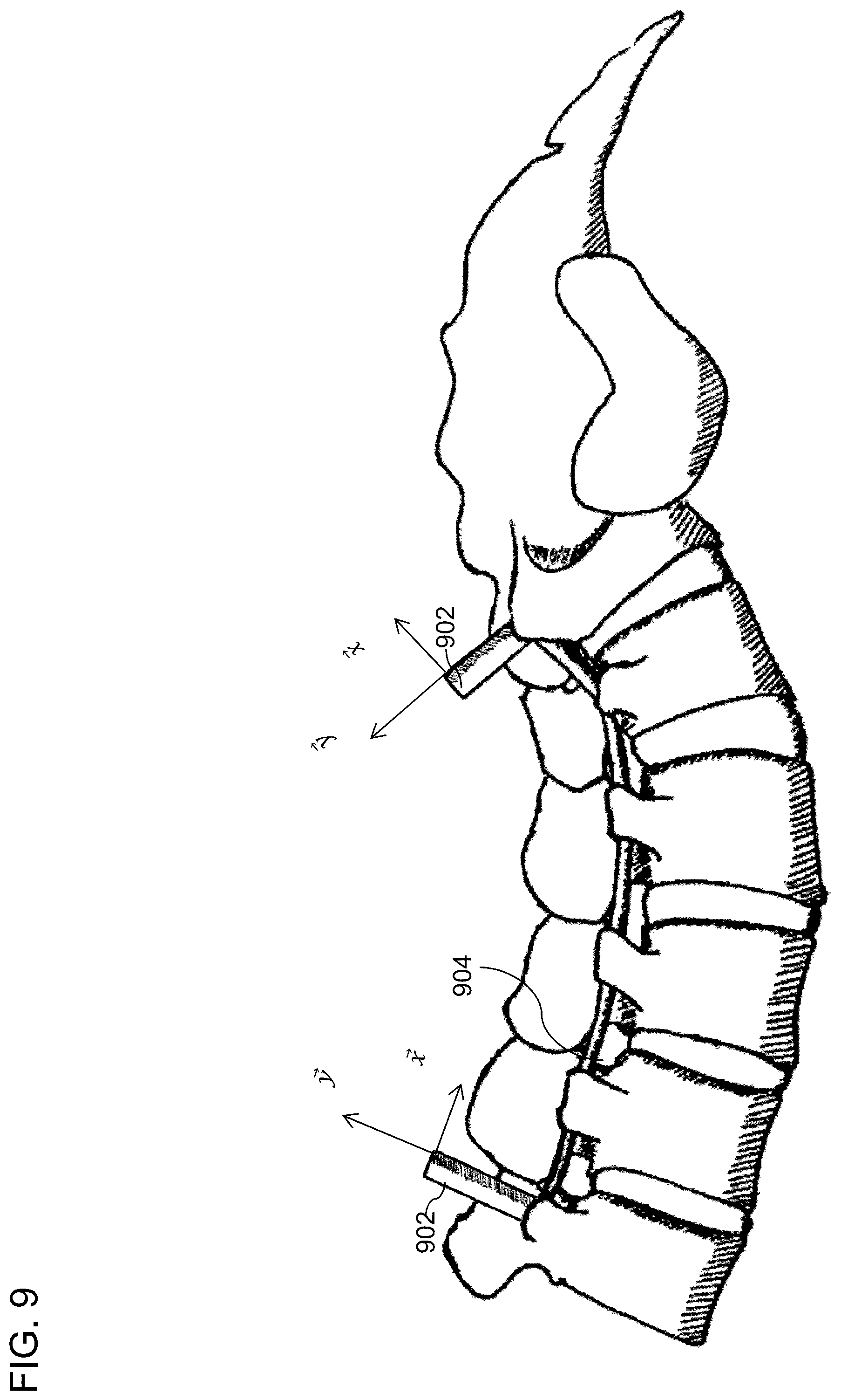 Patent US12564447 Figure 9 – Systems, methods, and devices for developing patient-specific spinal implants, treatments, operations, and/or procedures