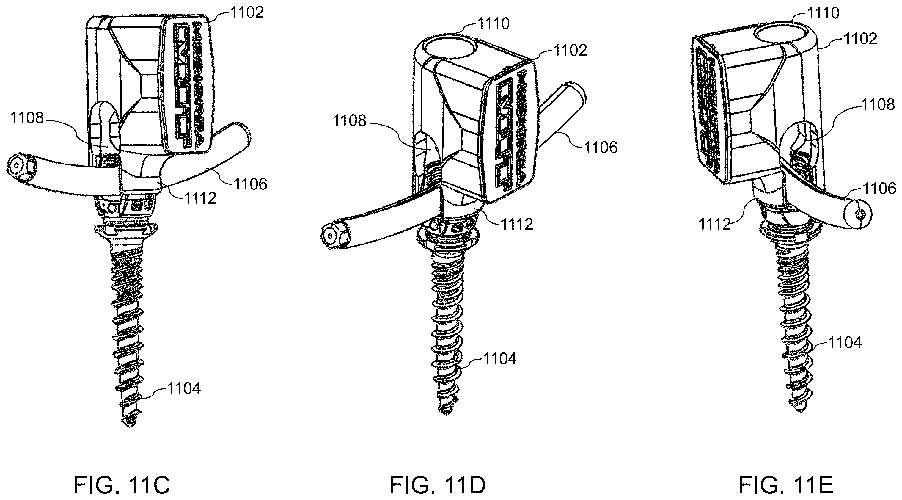 Patent US12564447 Figure 13 – Systems, methods, and devices for developing patient-specific spinal implants, treatments, operations, and/or procedures