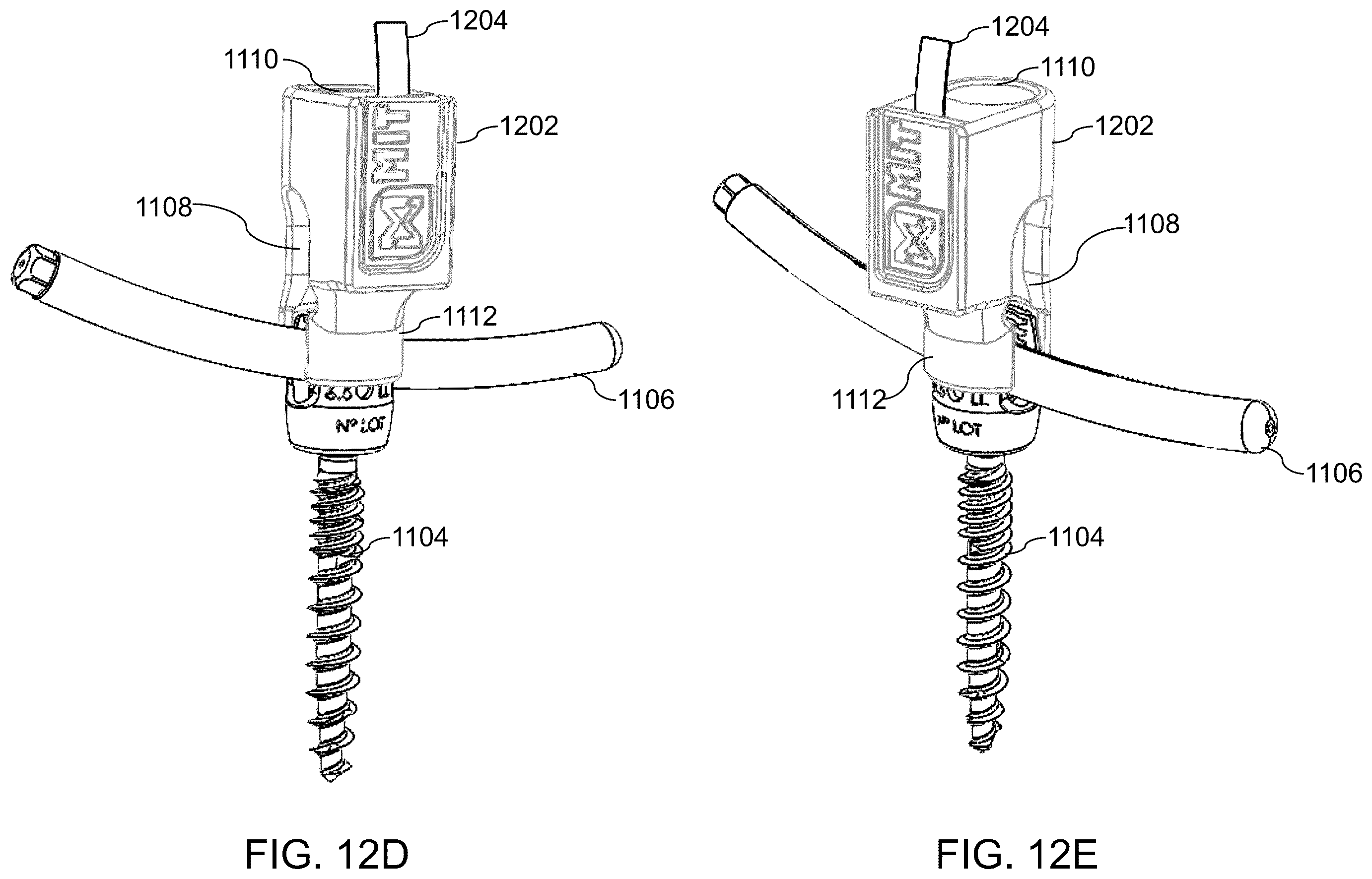 Patent US12564447 Figure 15 – Systems, methods, and devices for developing patient-specific spinal implants, treatments, operations, and/or procedures