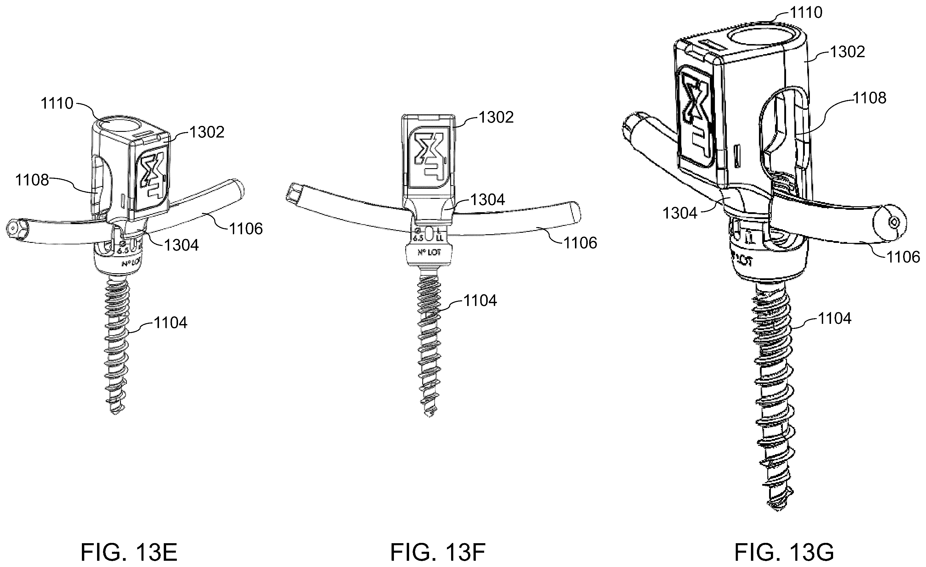 Patent US12564447 Figure 17 – Systems, methods, and devices for developing patient-specific spinal implants, treatments, operations, and/or procedures