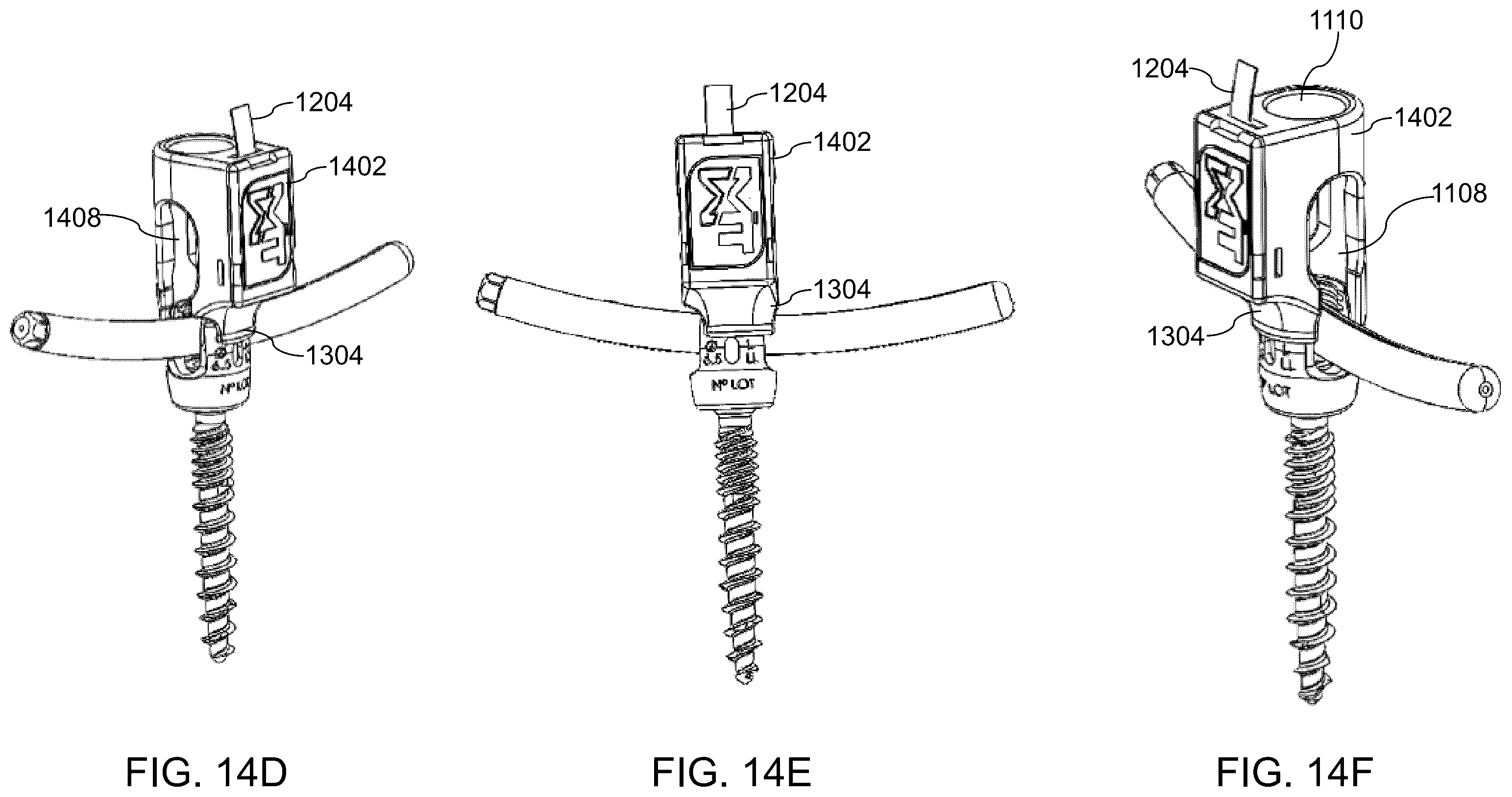 Patent US12564447 Figure 19 – Systems, methods, and devices for developing patient-specific spinal implants, treatments, operations, and/or procedures