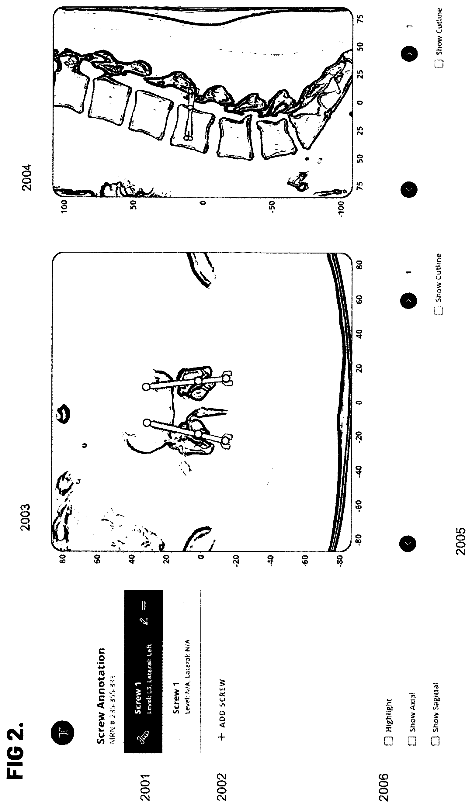 Patent US12564448 Figure 2 – Pedicle screw and implant placement prediction engine