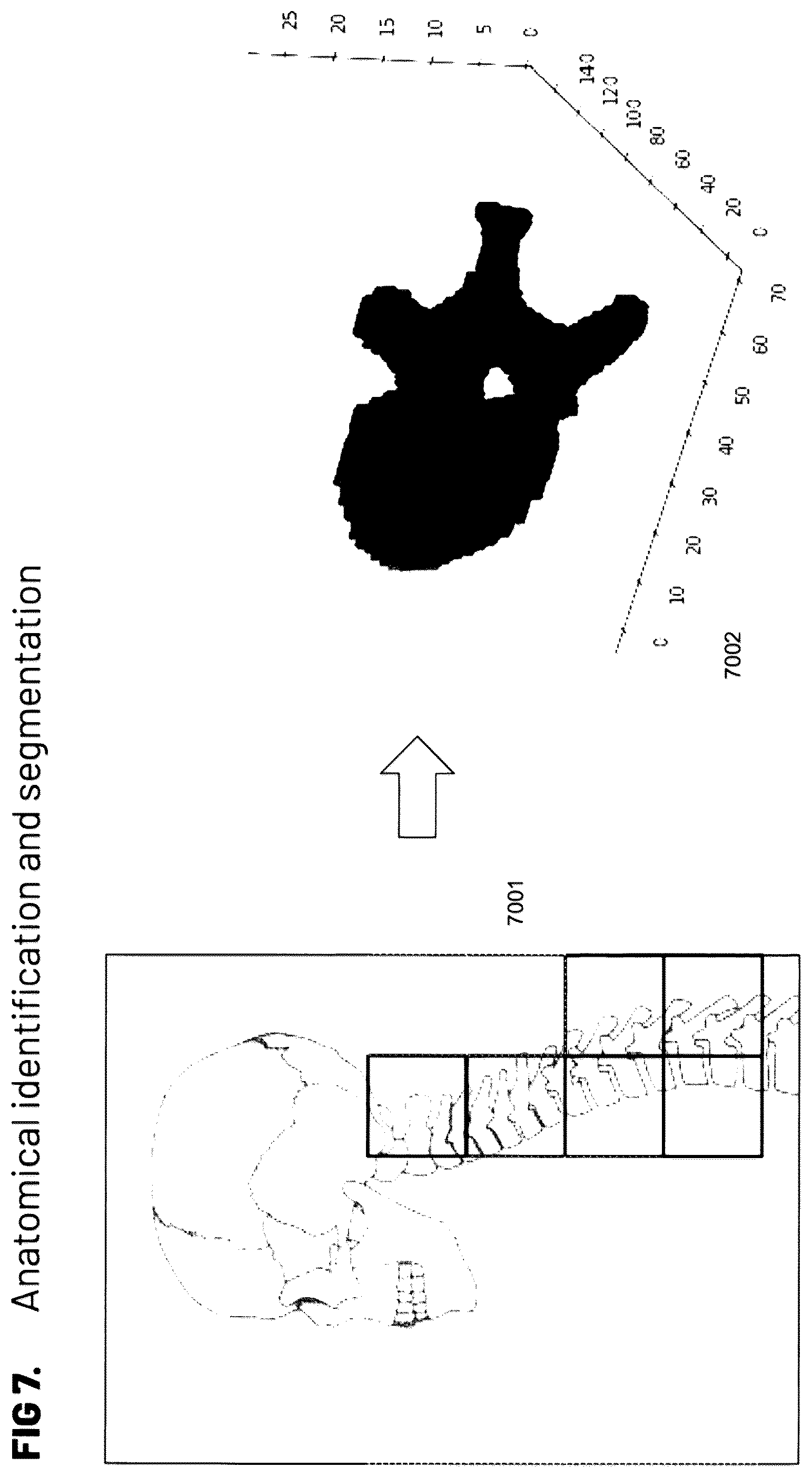 Patent US12564448 Figure 7 – Pedicle screw and implant placement prediction engine