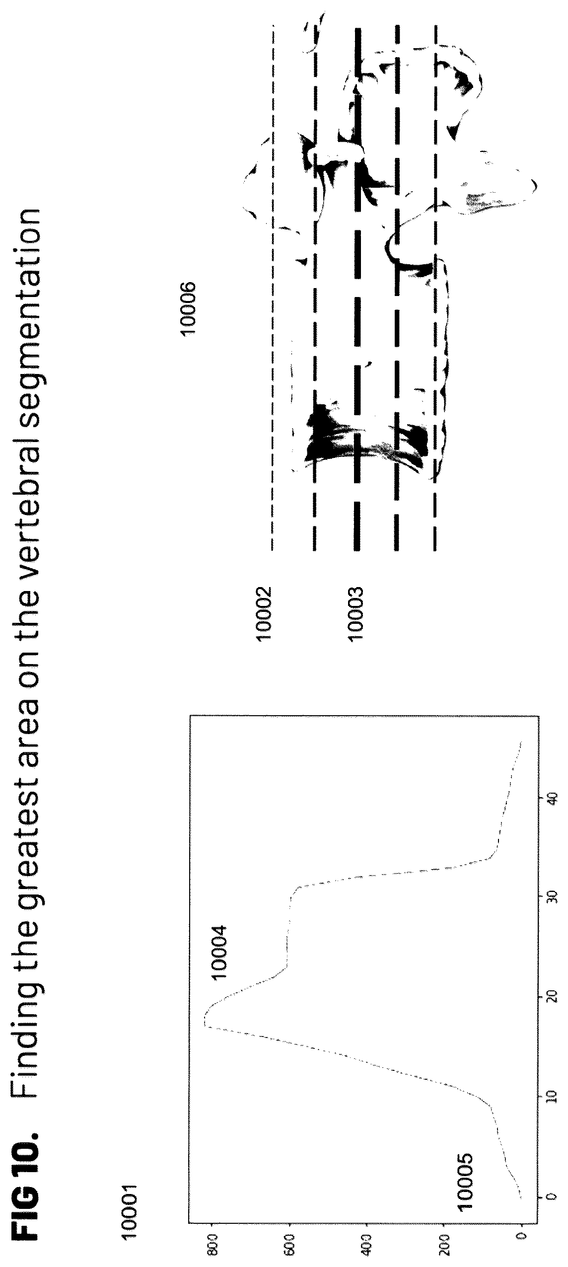Patent US12564448 Figure 10 – Pedicle screw and implant placement prediction engine