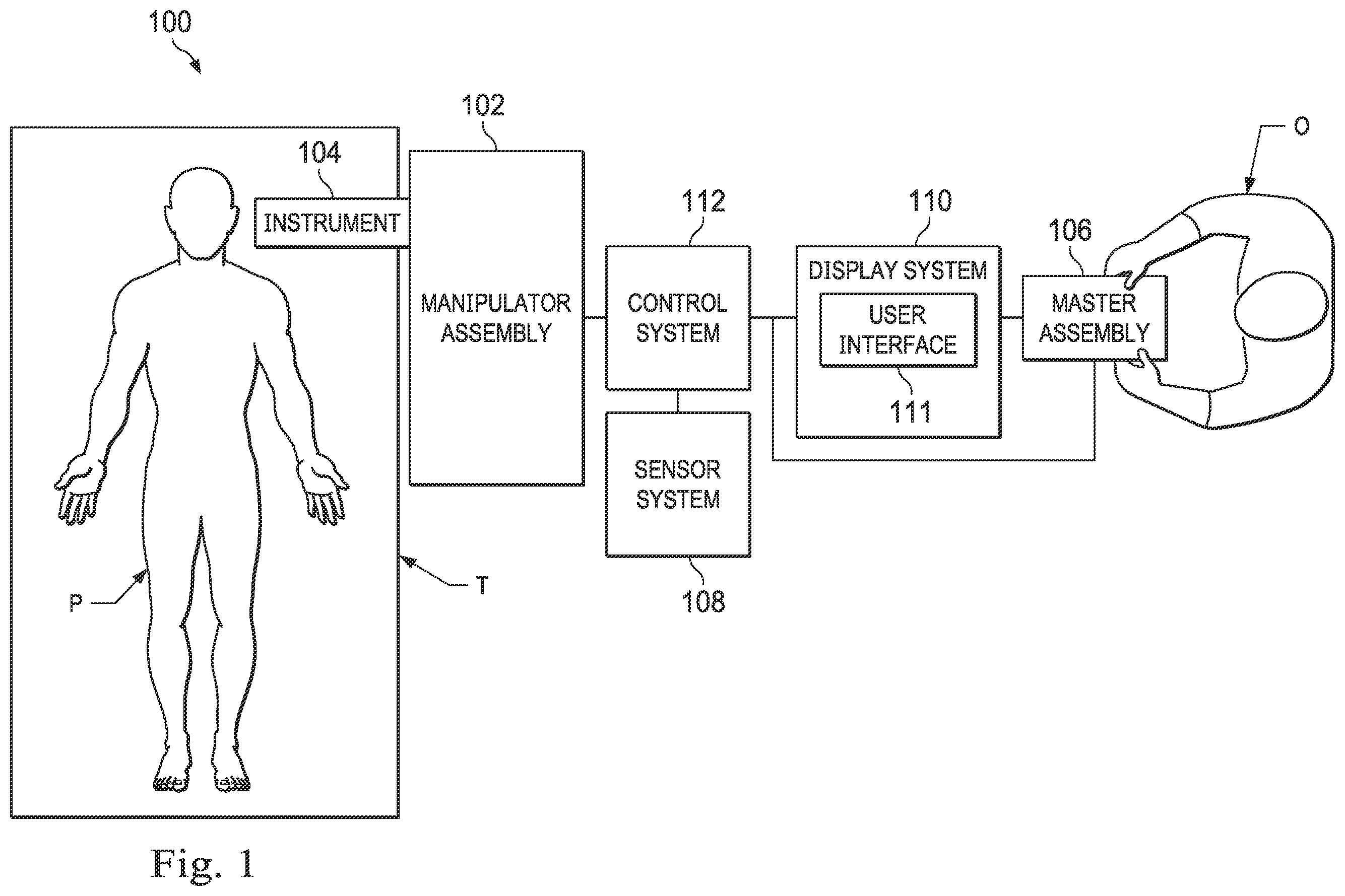 Patent US12564449 Figure 1 – Systems and methods for registration of patient anatomy