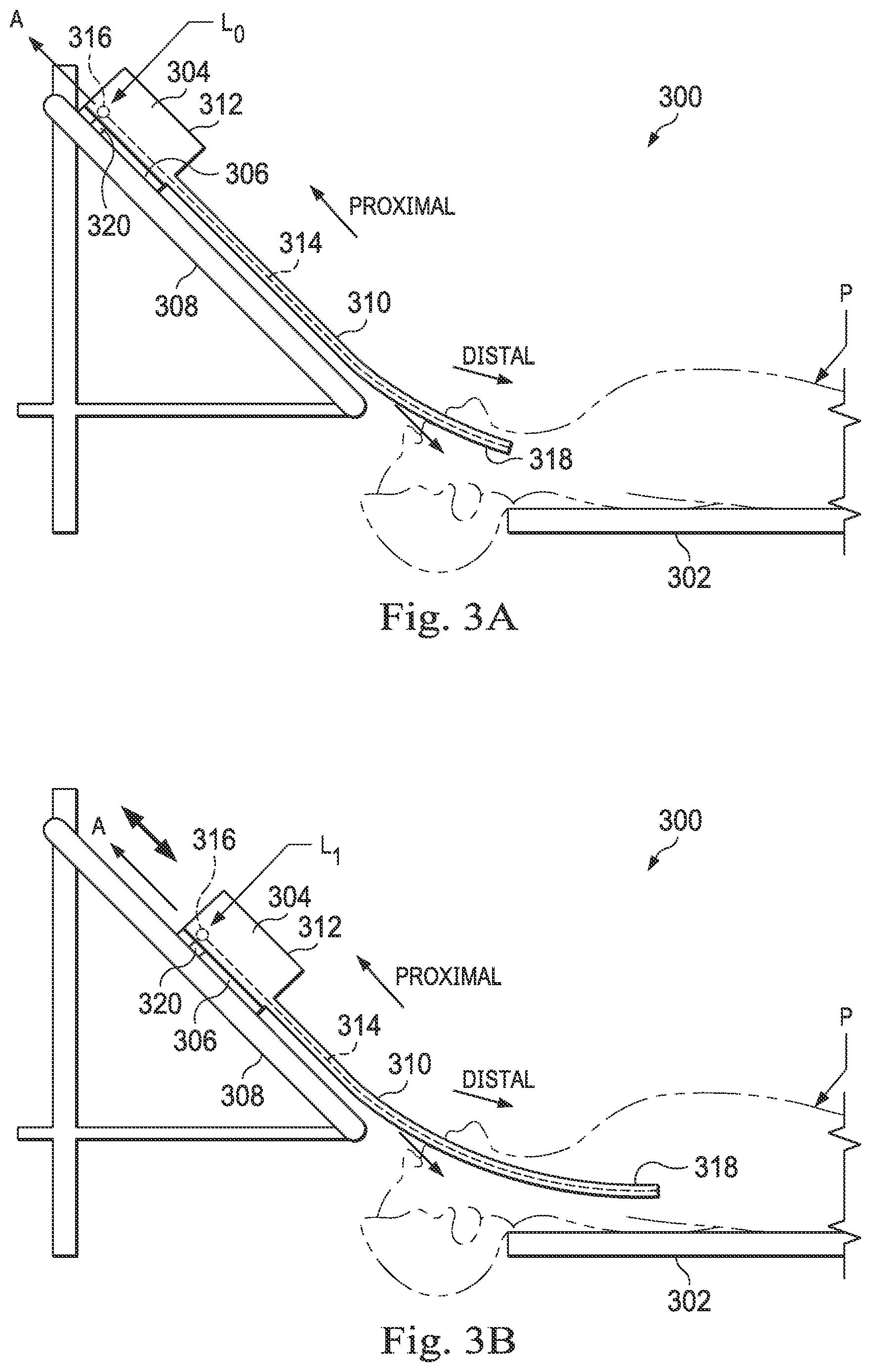 Patent US12564449 Figure 3 – Systems and methods for registration of patient anatomy