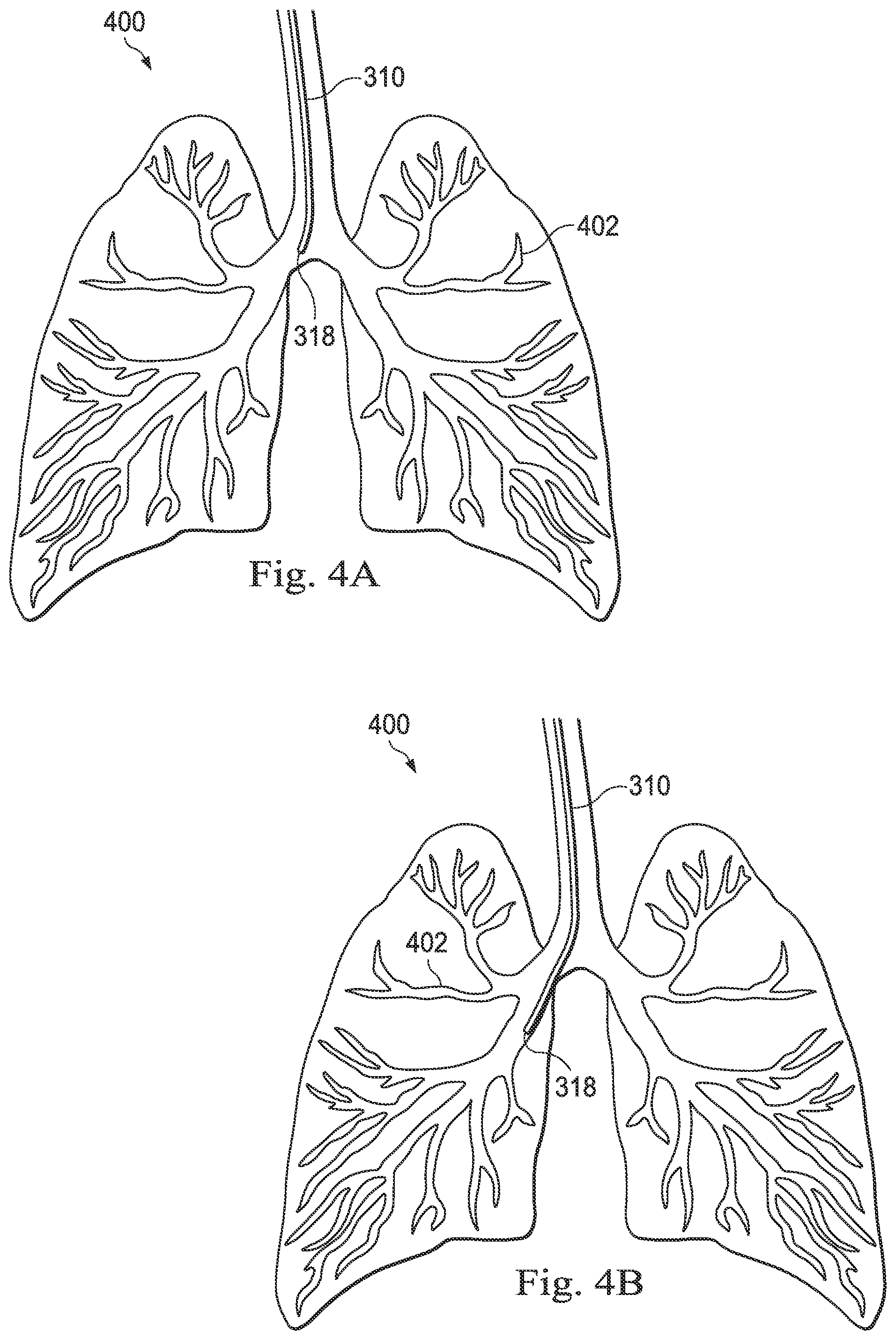 Patent US12564449 Figure 4 – Systems and methods for registration of patient anatomy