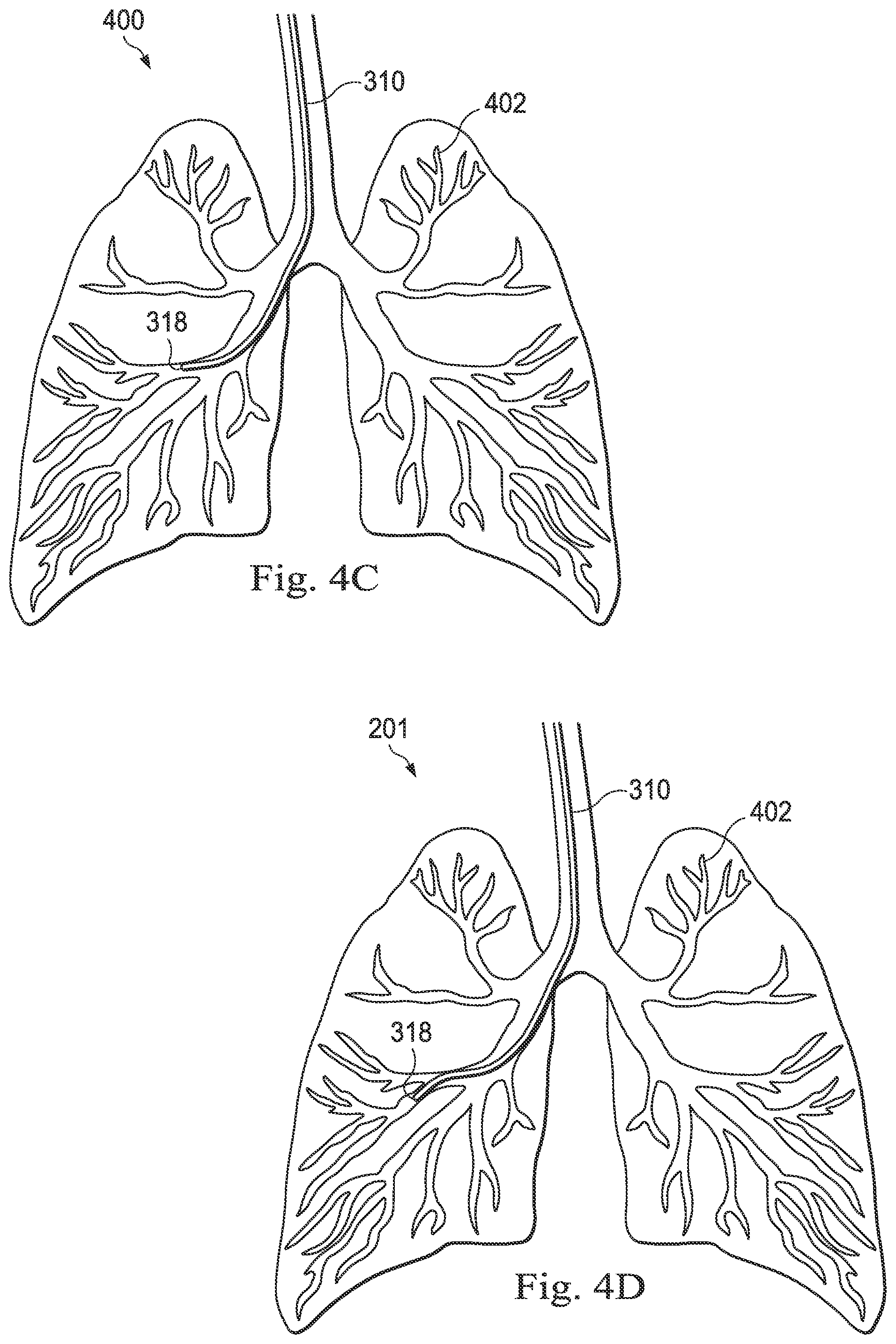 Patent US12564449 Figure 5 – Systems and methods for registration of patient anatomy