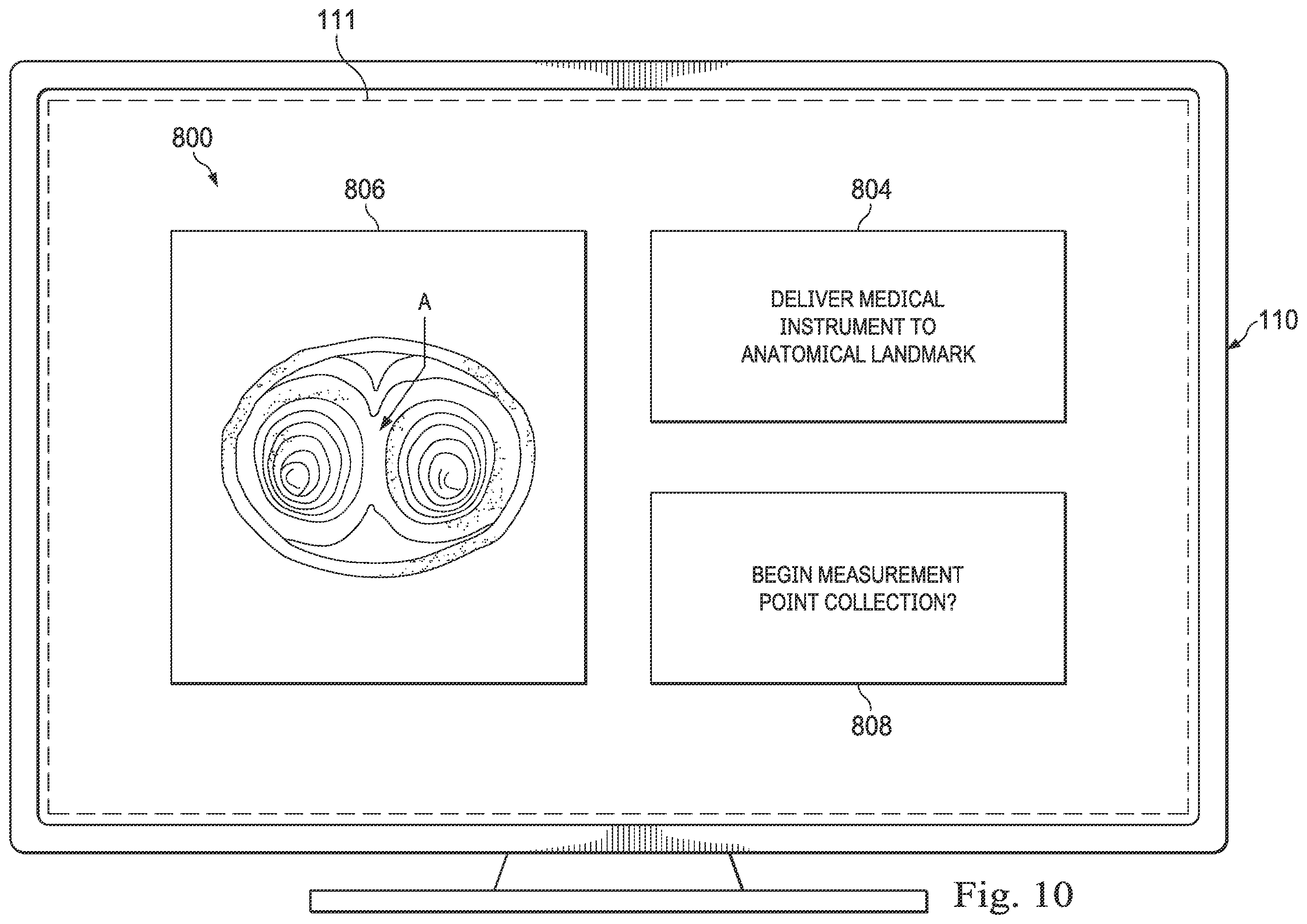 Patent US12564449 Figure 10 – Systems and methods for registration of patient anatomy