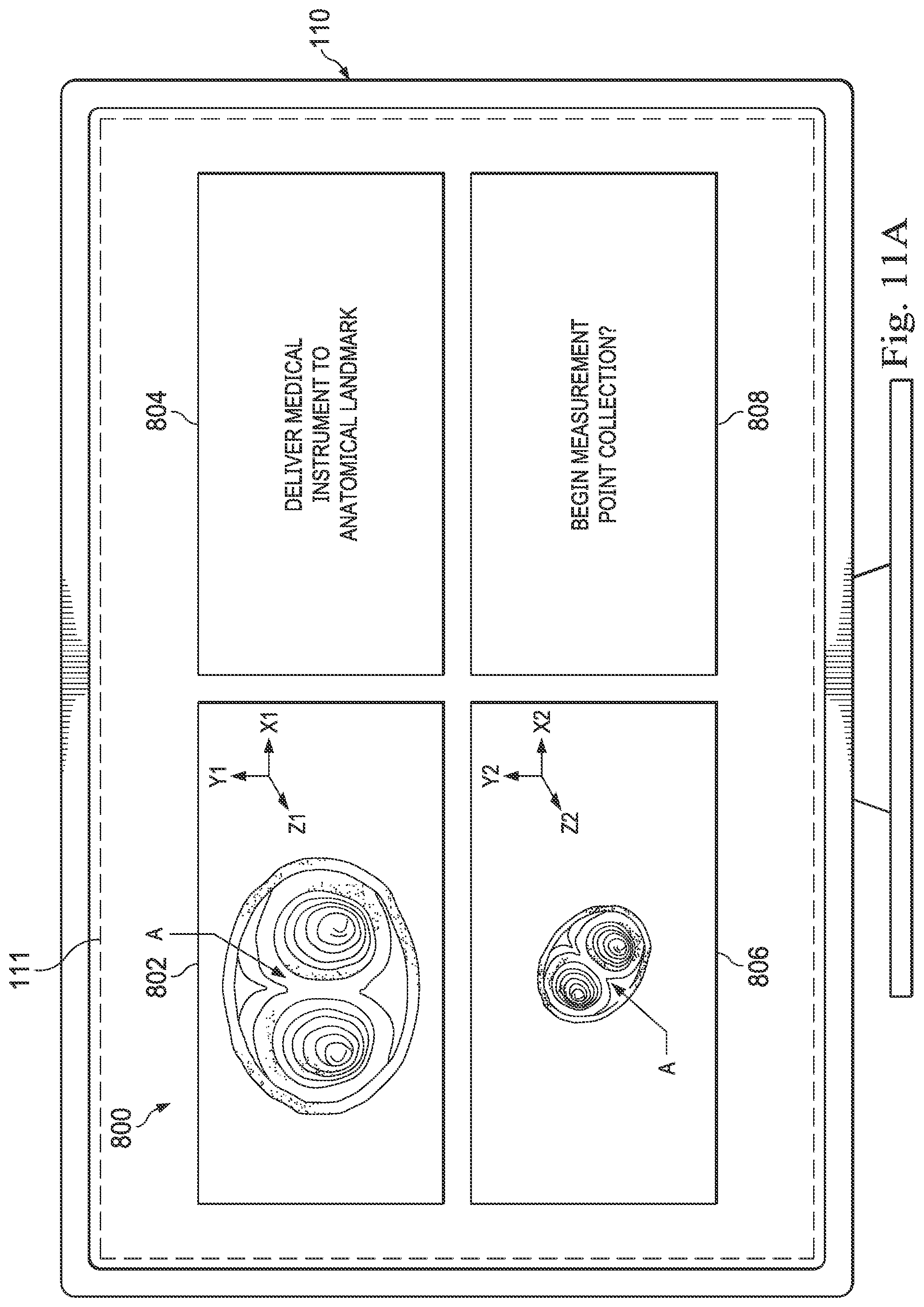Patent US12564449 Figure 11 – Systems and methods for registration of patient anatomy
