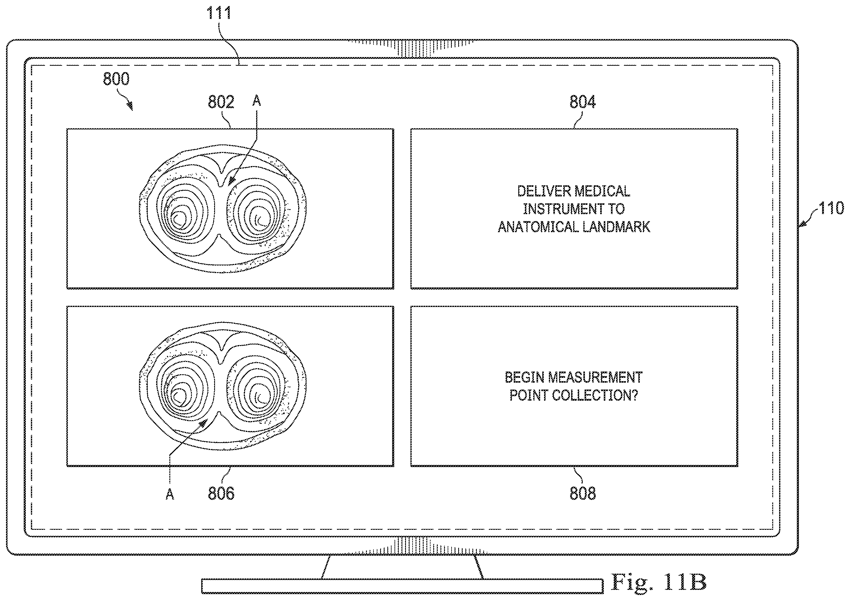 Patent US12564449 Figure 12 – Systems and methods for registration of patient anatomy