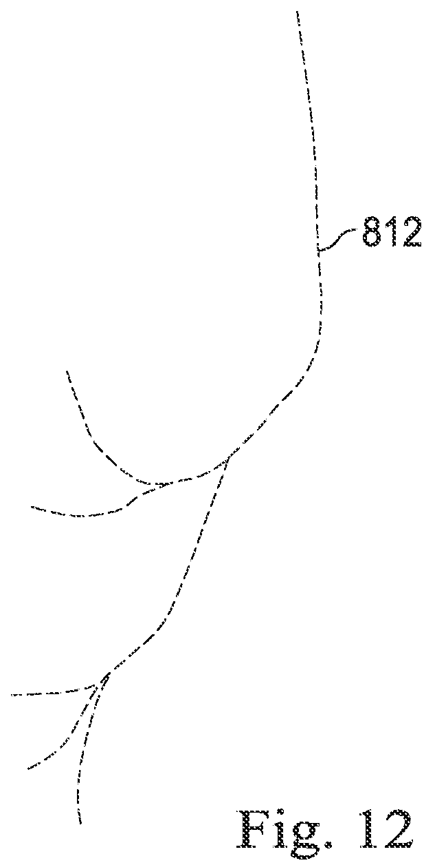 Patent US12564449 Figure 13 – Systems and methods for registration of patient anatomy