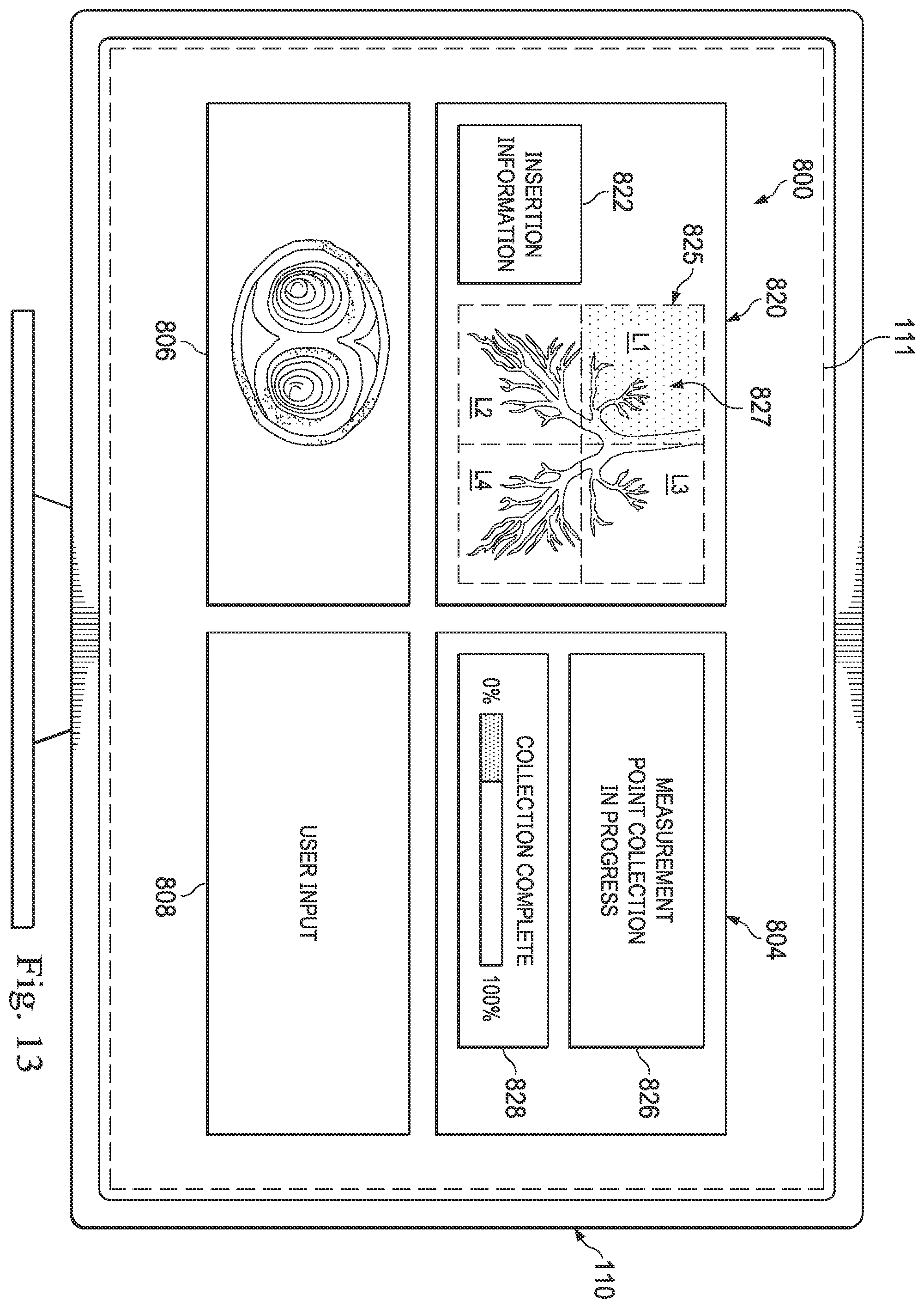 Patent US12564449 Figure 14 – Systems and methods for registration of patient anatomy