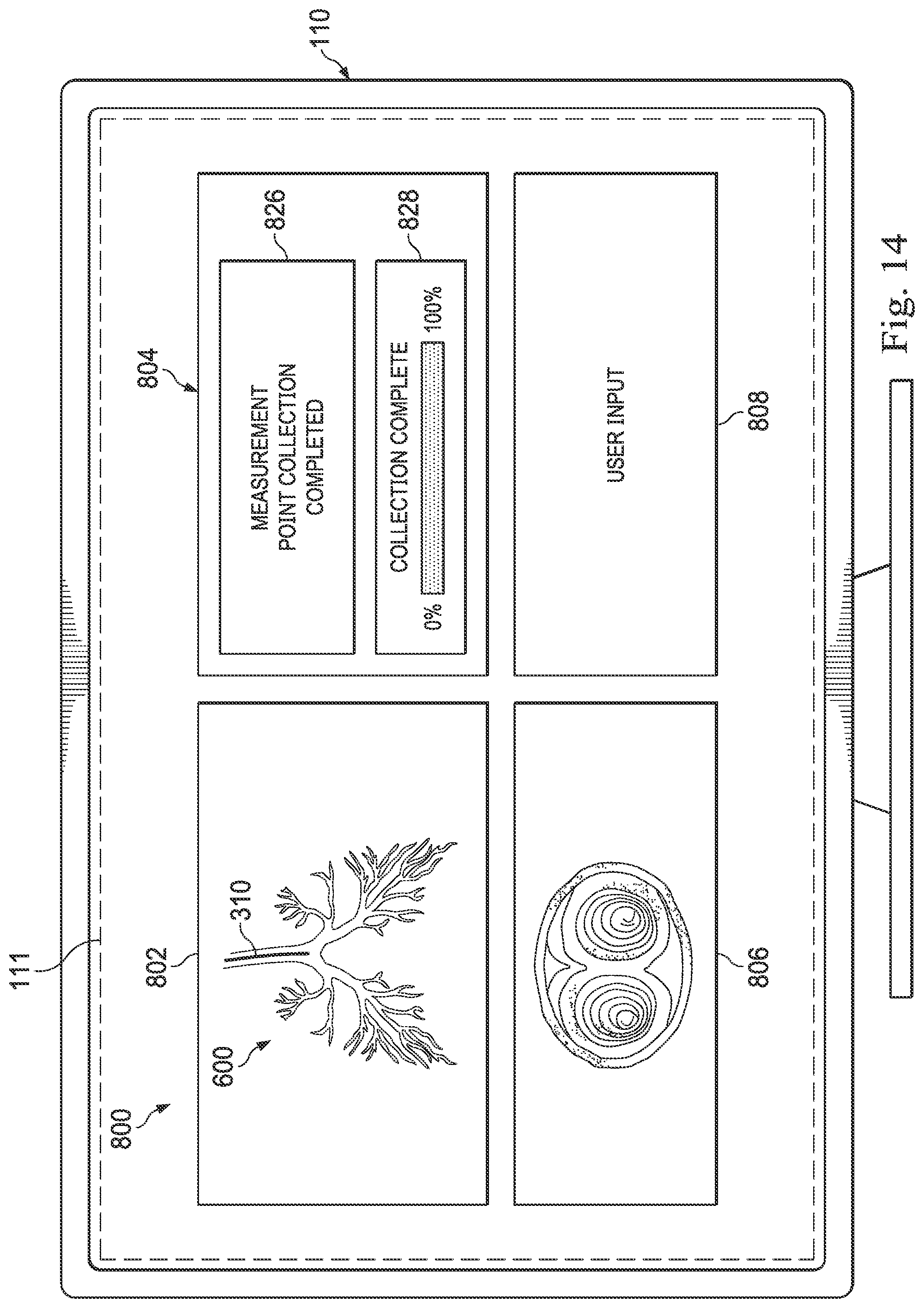 Patent US12564449 Figure 15 – Systems and methods for registration of patient anatomy
