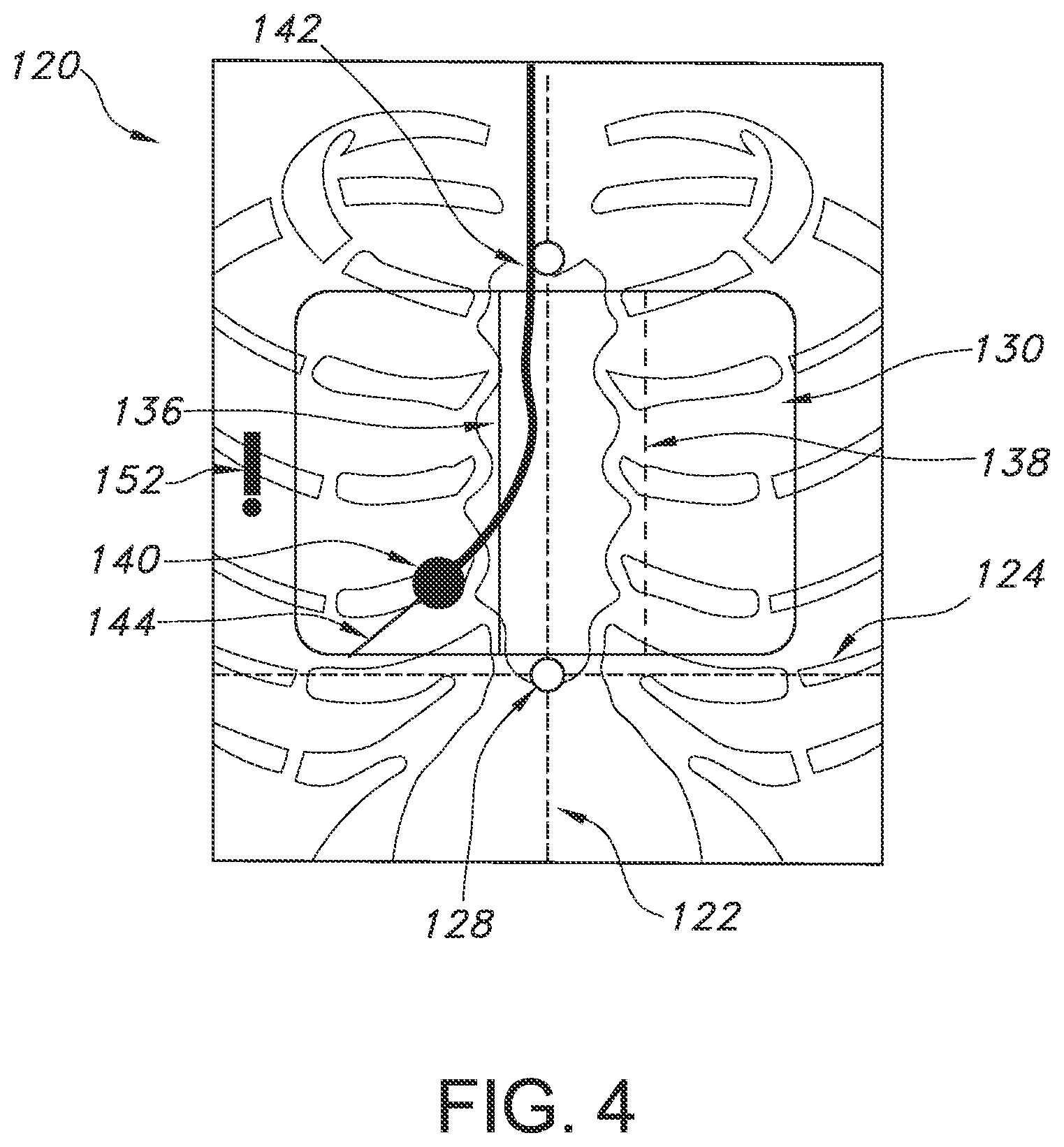 Patent US12564450 Figure 4 – Configurable system and method for indicating deviation from a medical device placement pathway