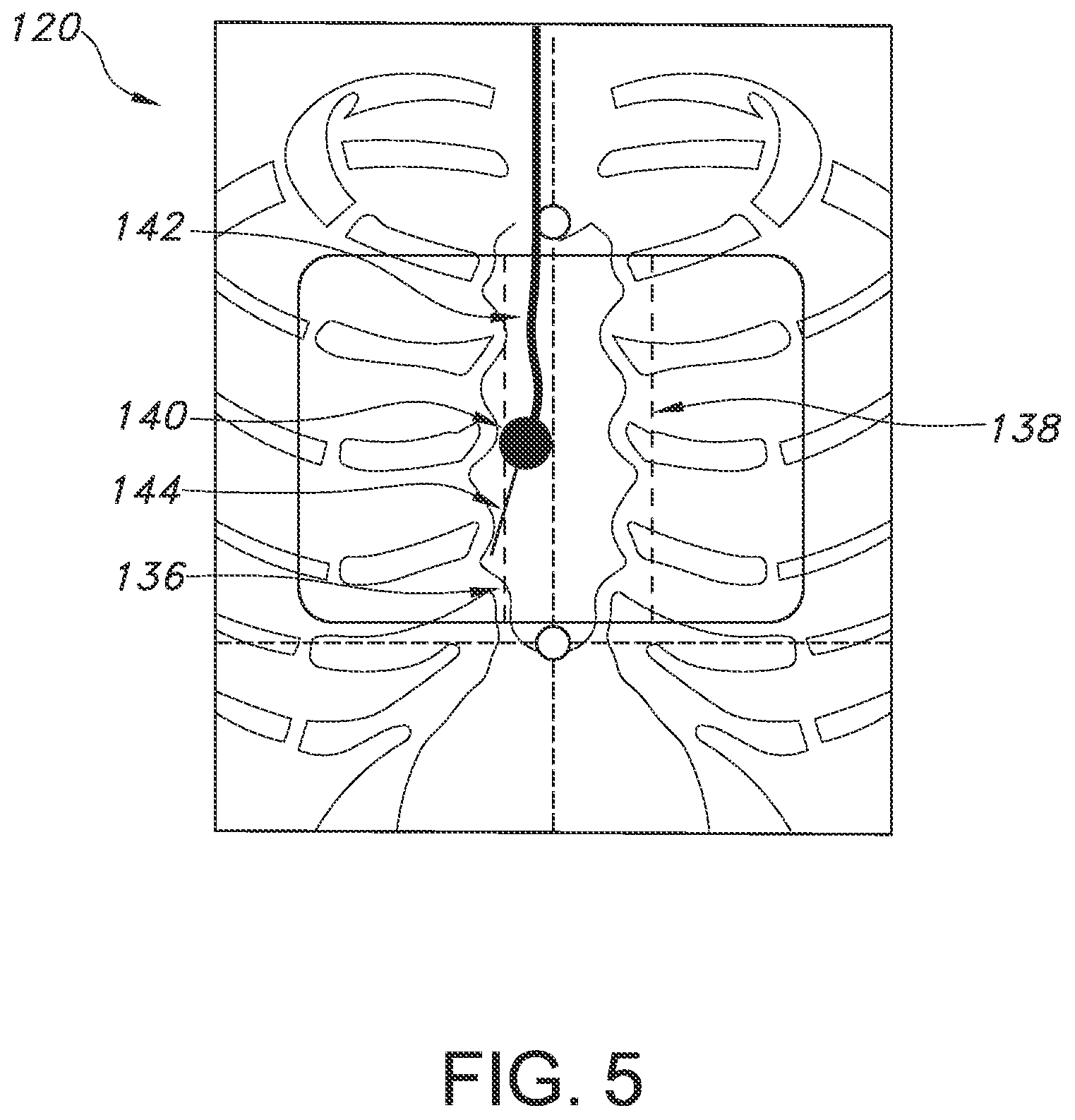 Patent US12564450 Figure 5 – Configurable system and method for indicating deviation from a medical device placement pathway