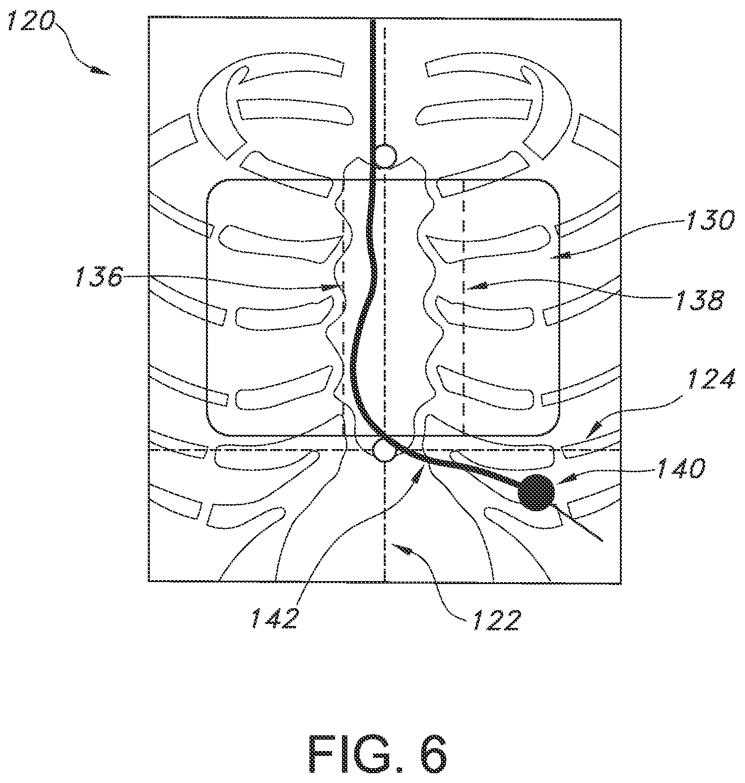 Patent US12564450 Figure 6 – Configurable system and method for indicating deviation from a medical device placement pathway