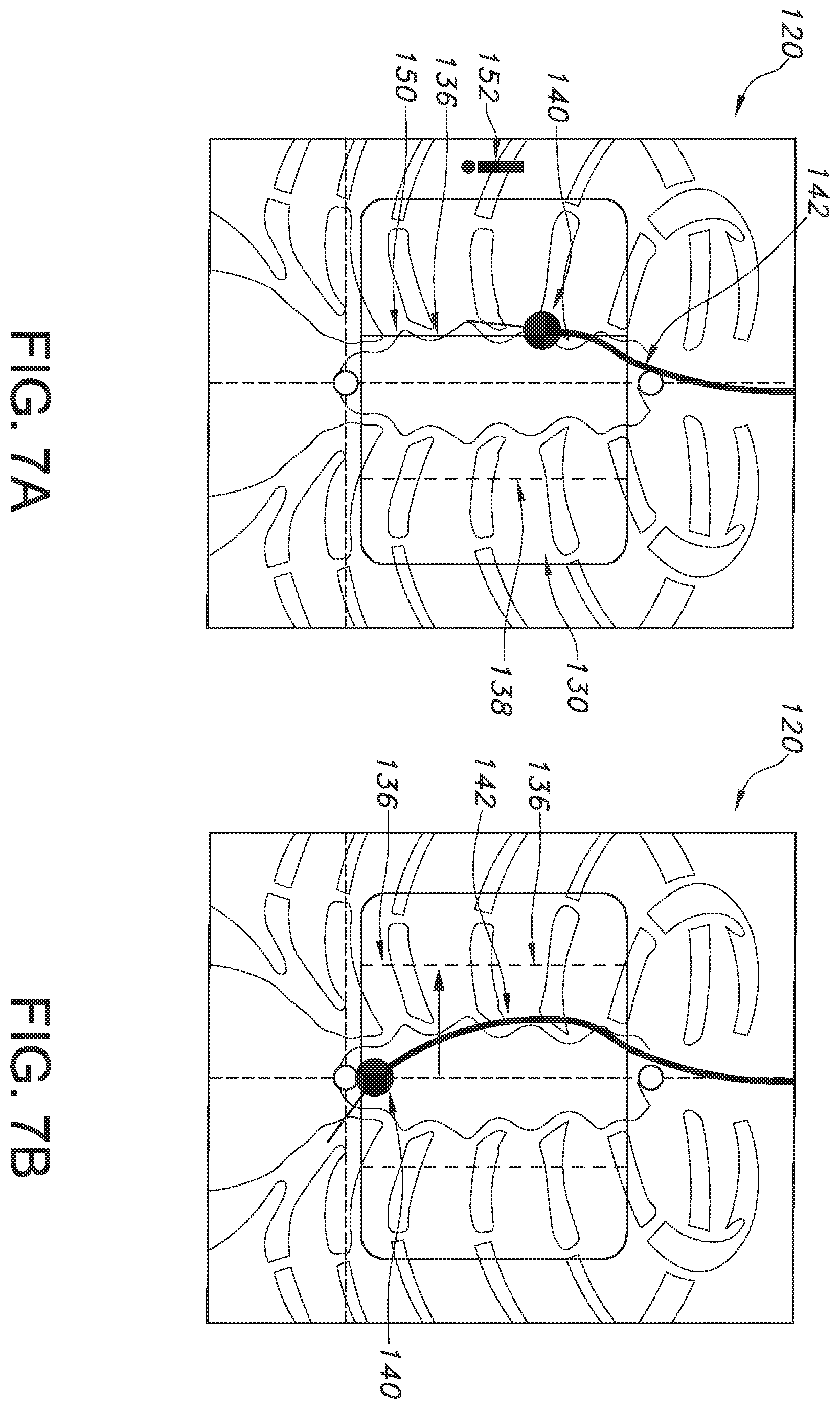 Patent US12564450 Figure 7 – Configurable system and method for indicating deviation from a medical device placement pathway