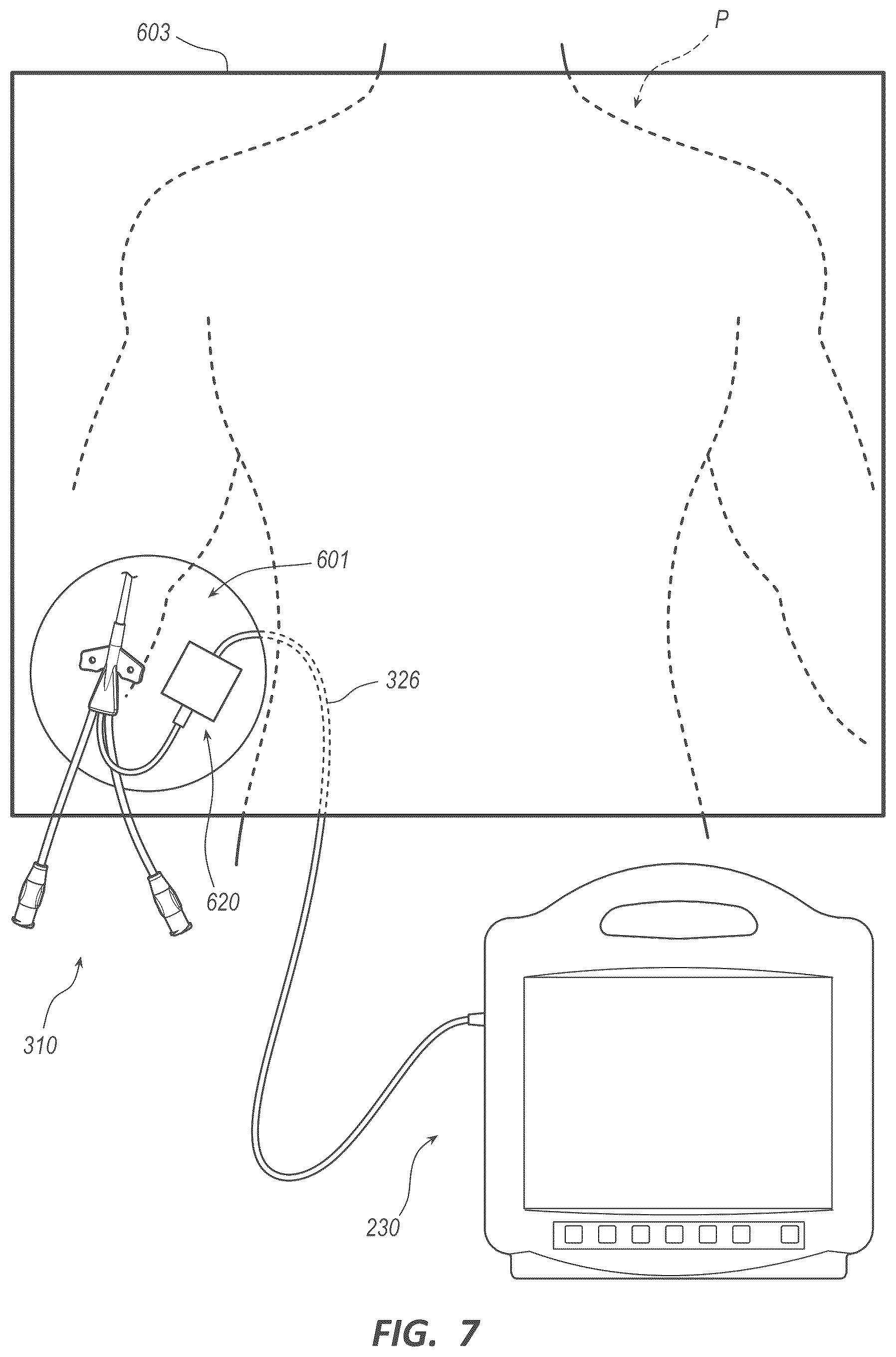 Patent US12564453 Figure 5 – Optical-fiber connector modules including shape-sensing systems and methods thereof