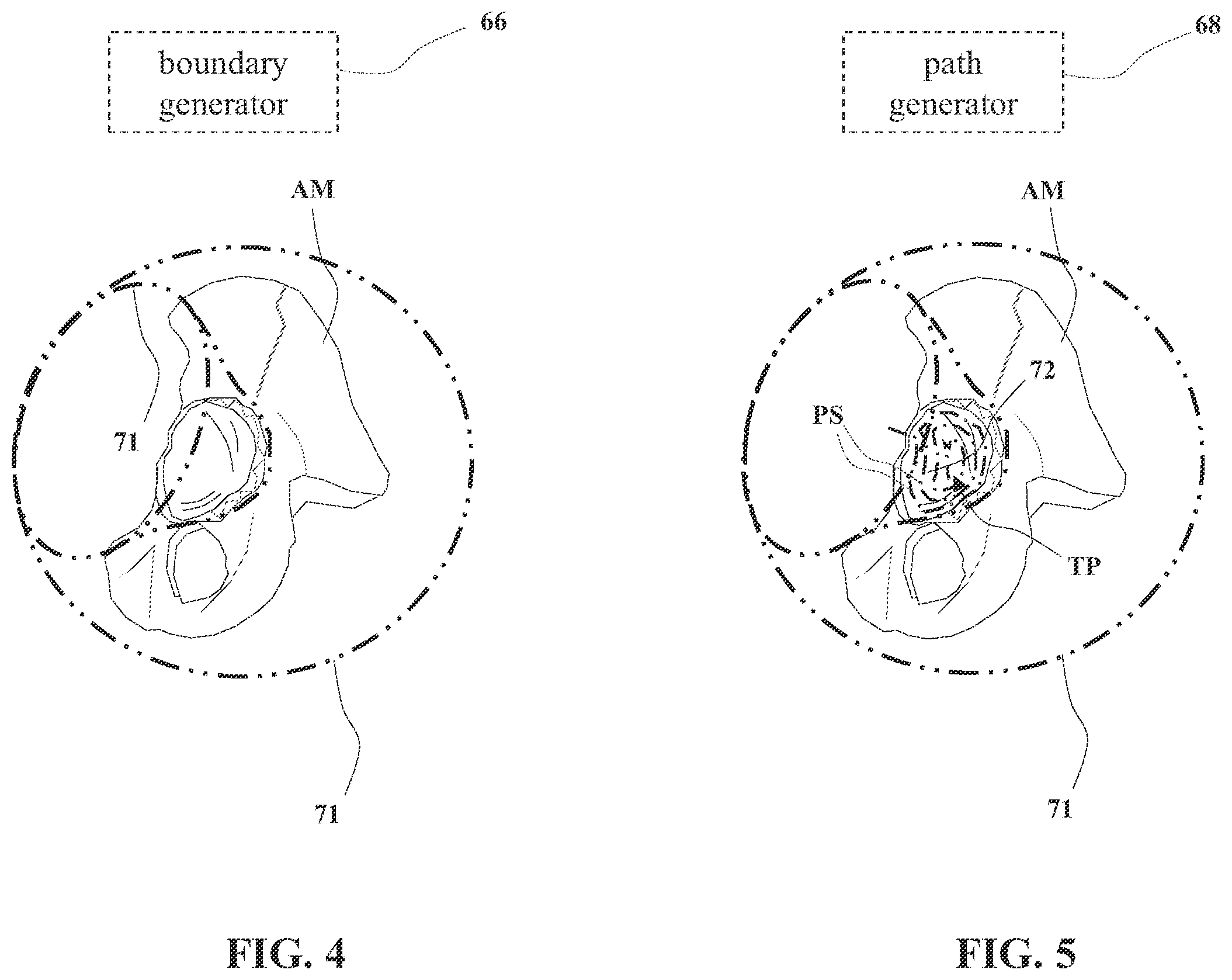 Patent US12564455 Figure 4 – Systems and methods for controlling robotic movement of a tool based on a virtual boundary