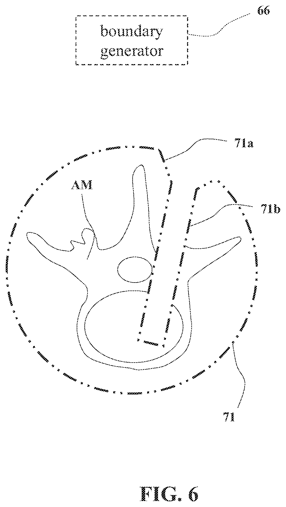 Patent US12564455 Figure 5 – Systems and methods for controlling robotic movement of a tool based on a virtual boundary