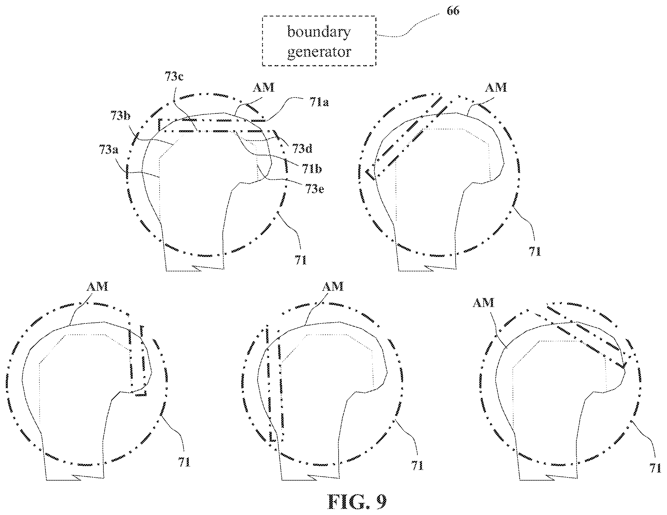 Patent US12564455 Figure 7 – Systems and methods for controlling robotic movement of a tool based on a virtual boundary
