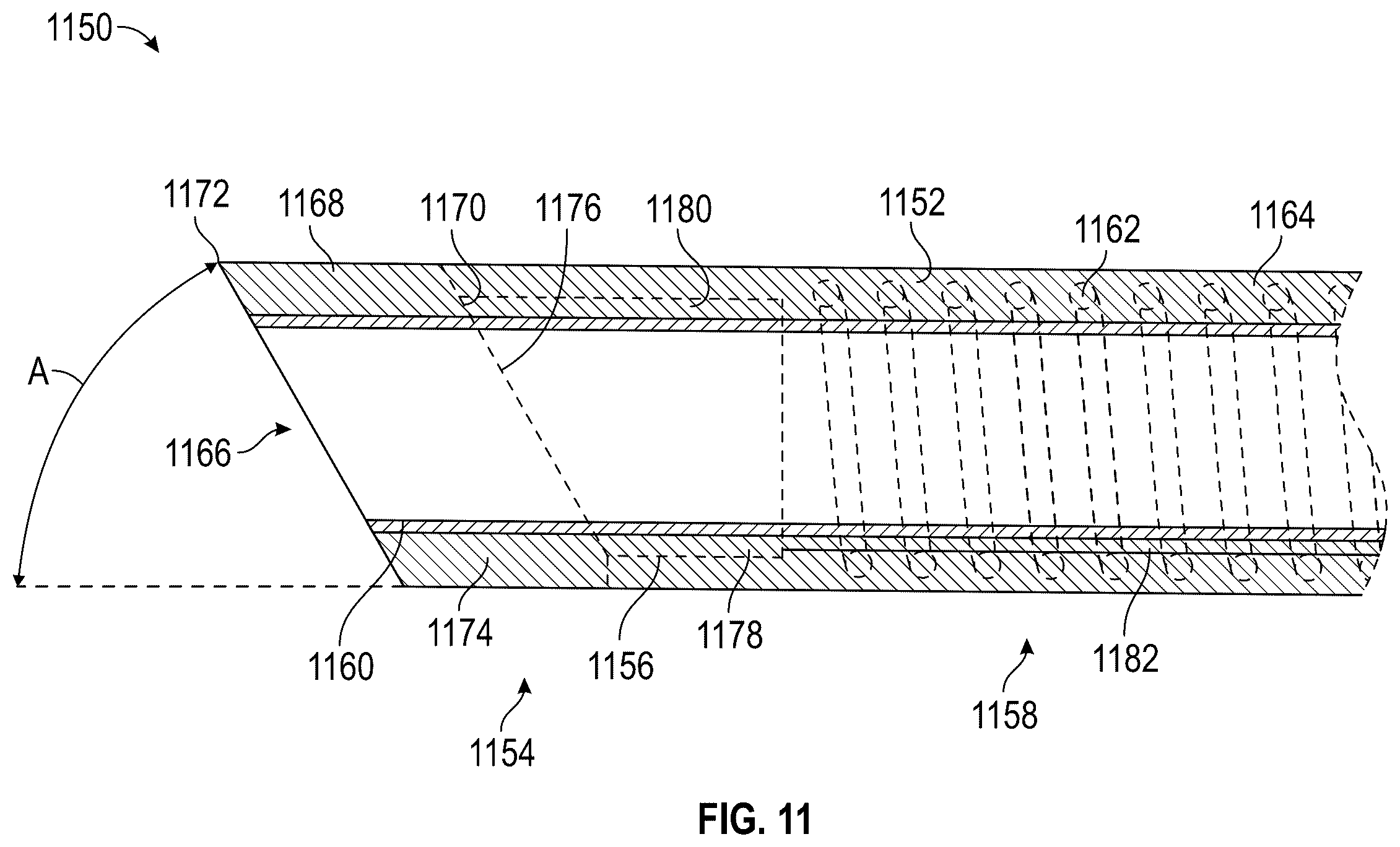 Patent US12564458 Figure 12 – Method of robotically driving a multi catheter assembly above the aortic arch