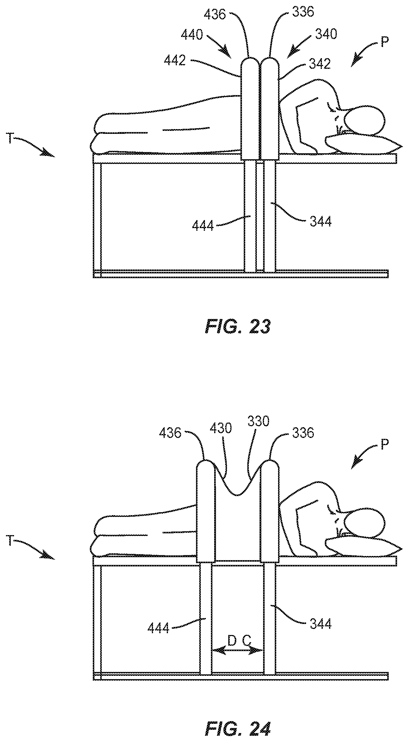 Patent US12564464 Figure 11 – Surgical draping system and method