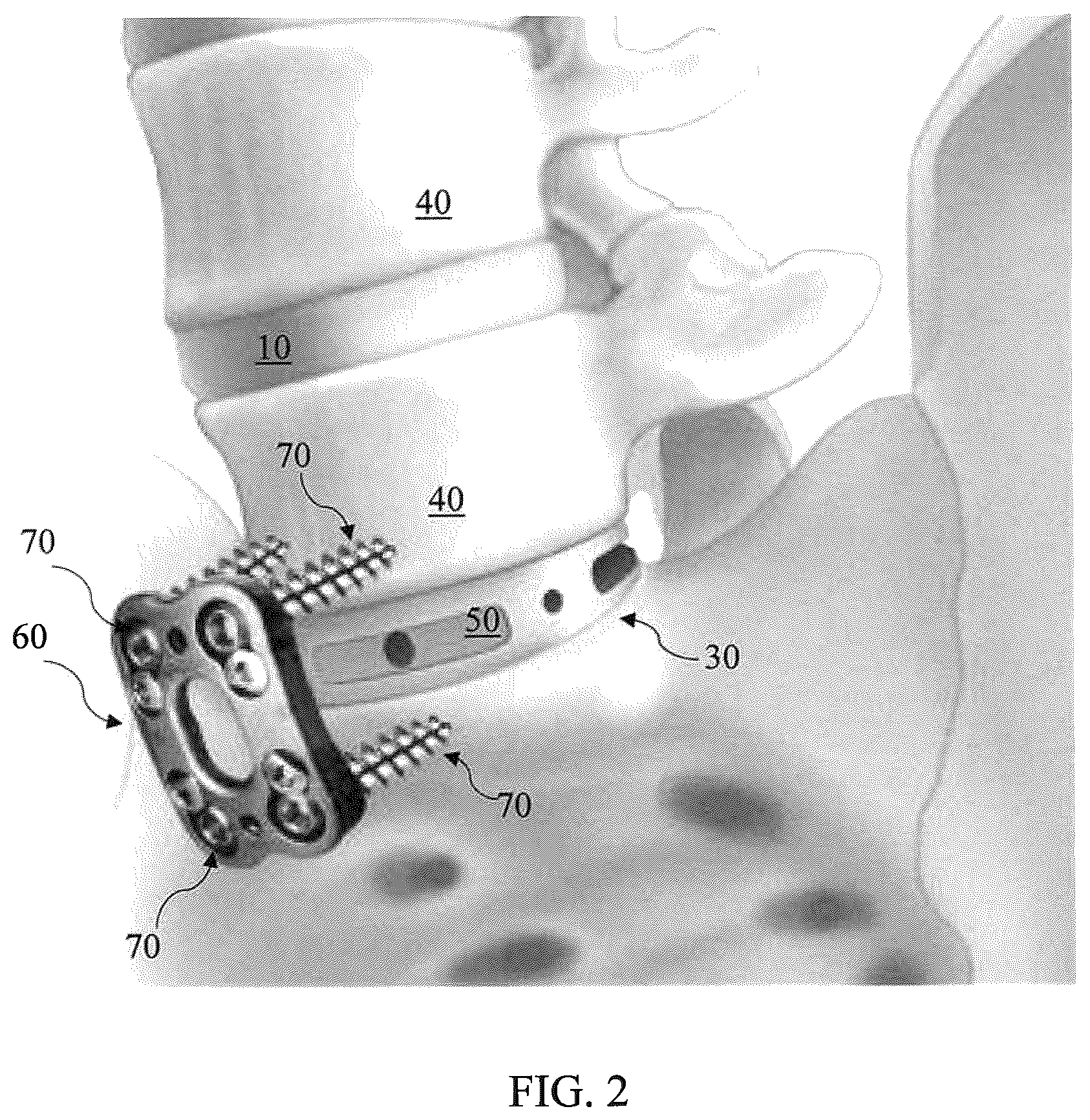 Patent US12564468 Figure 2 – Implant load feedback apparatus