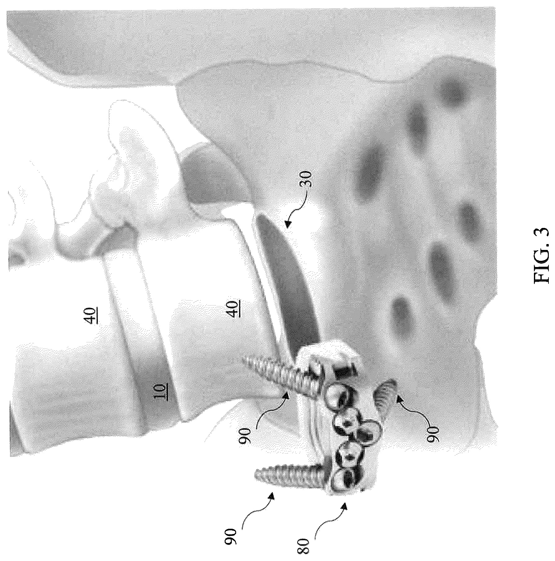 Patent US12564468 Figure 3 – Implant load feedback apparatus