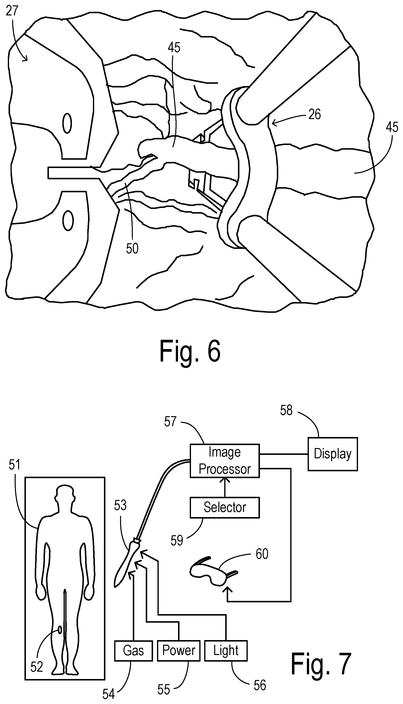 Patent US12564471 Figure 3 – Augmented-reality endoscopic vessel harvesting