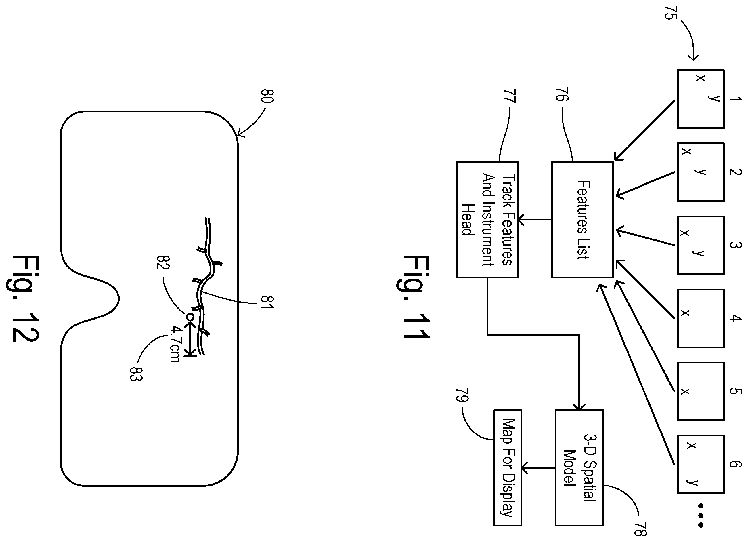 Patent US12564471 Figure 5 – Augmented-reality endoscopic vessel harvesting